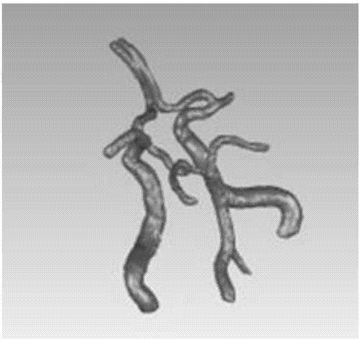 Computational fluid mechanics-based cerebrovascular reserve capacity simulation system and method