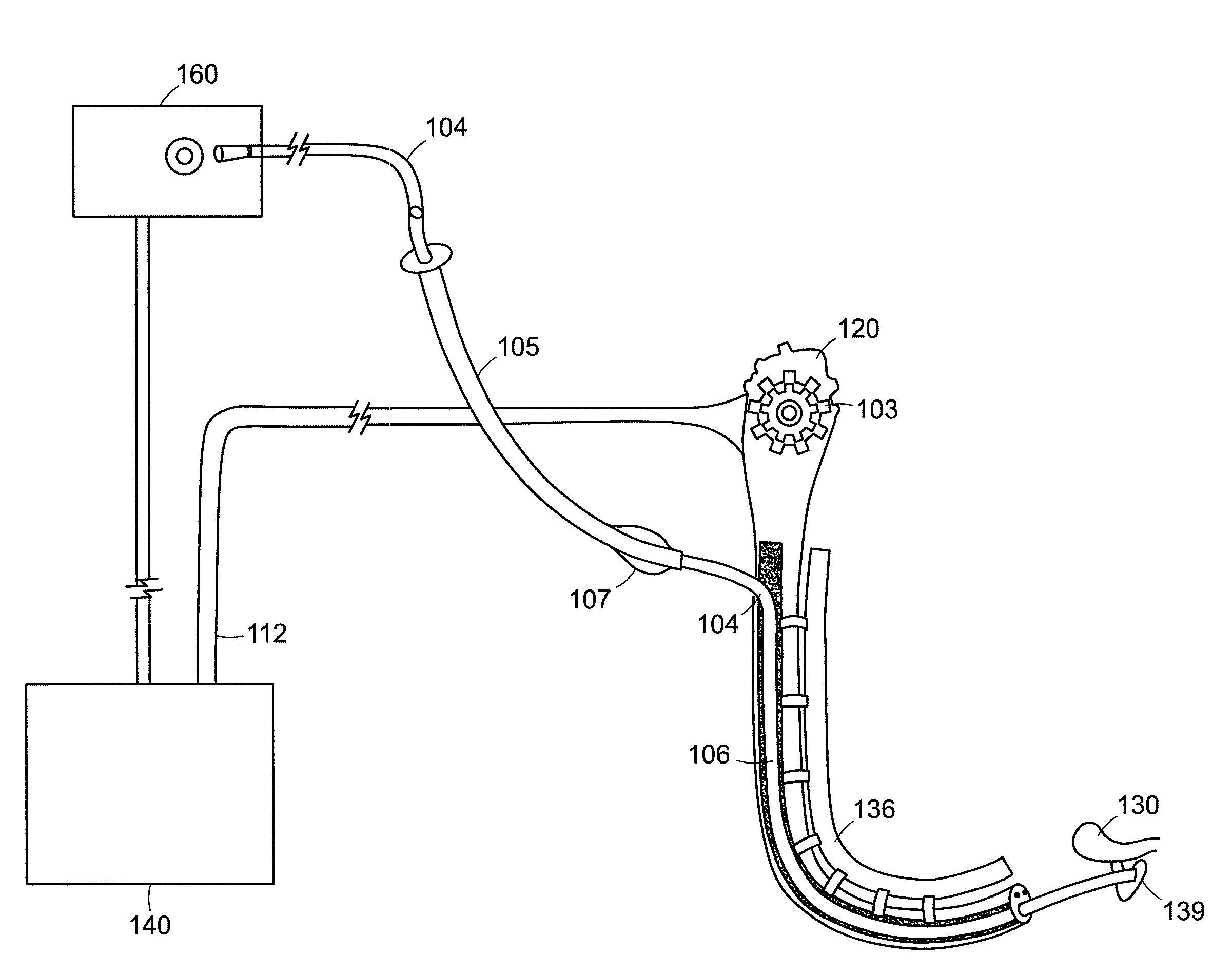 Catheter guided endotracheal intubation