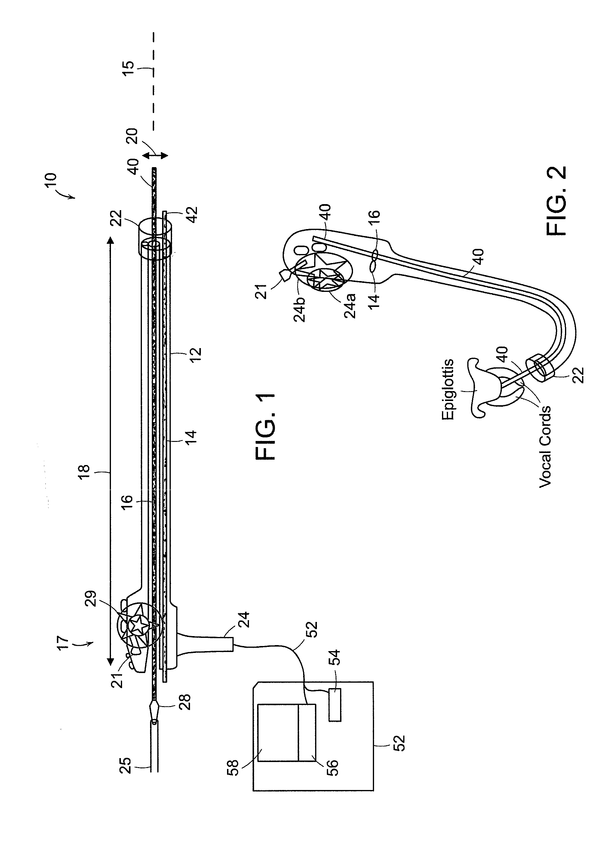 Catheter guided endotracheal intubation