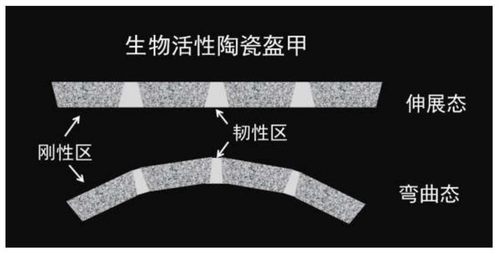 Mechanically adaptable bioactive ceramic armor and its preparation method