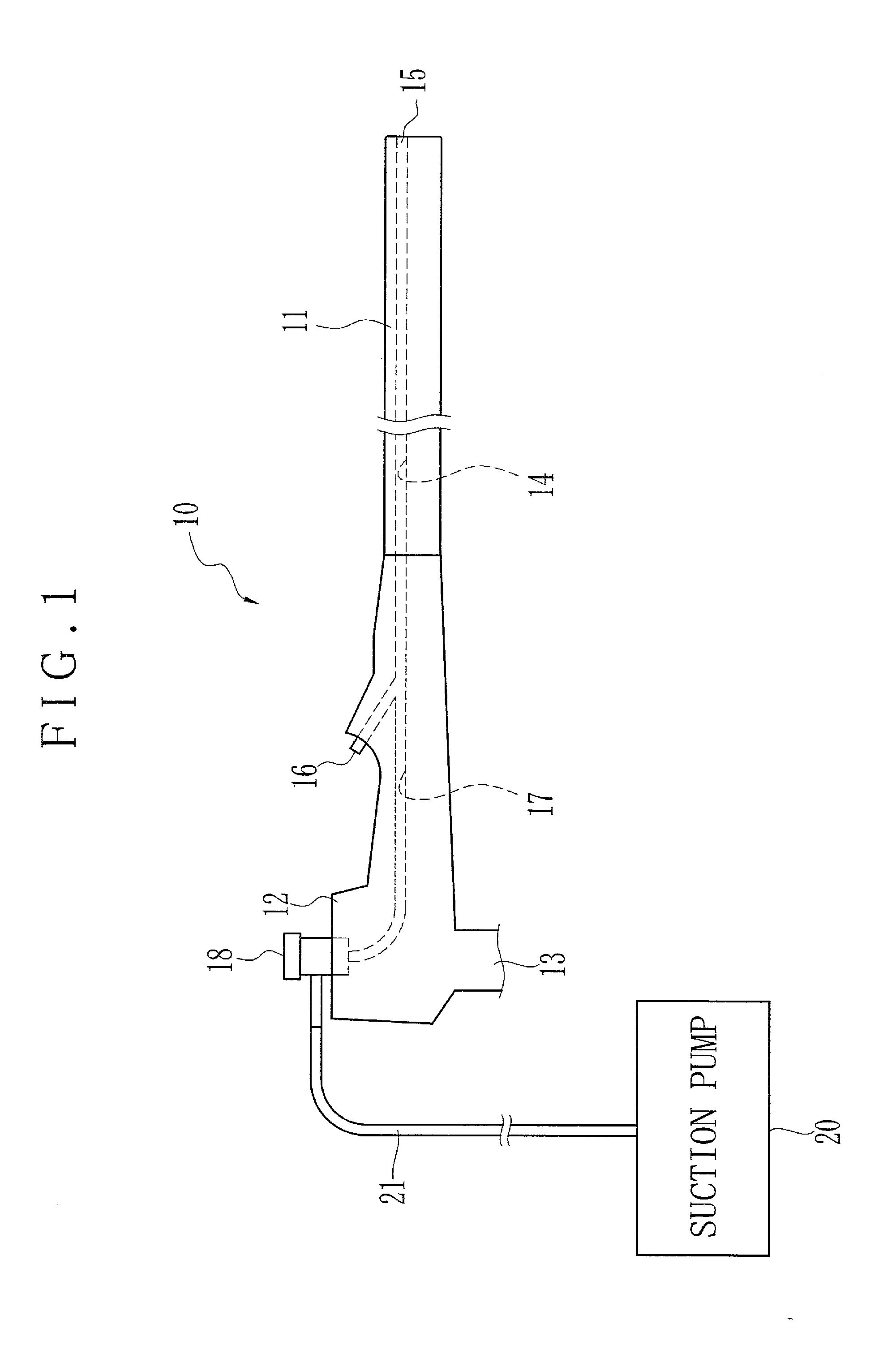 Suction button assembly for endoscope