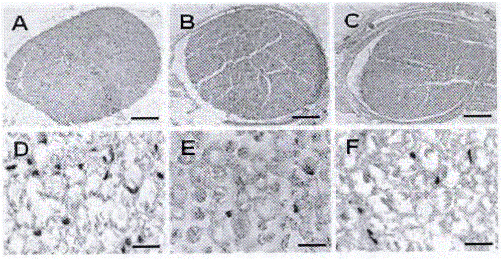 Drug for treating autoimmune neuritis