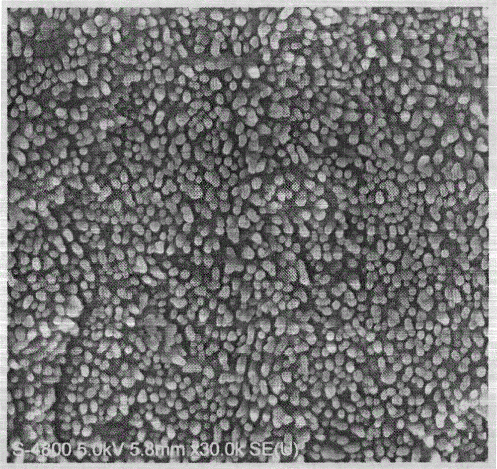 Preparation method of anti-osteoporosis bone implant micro/nano biomimetic coating