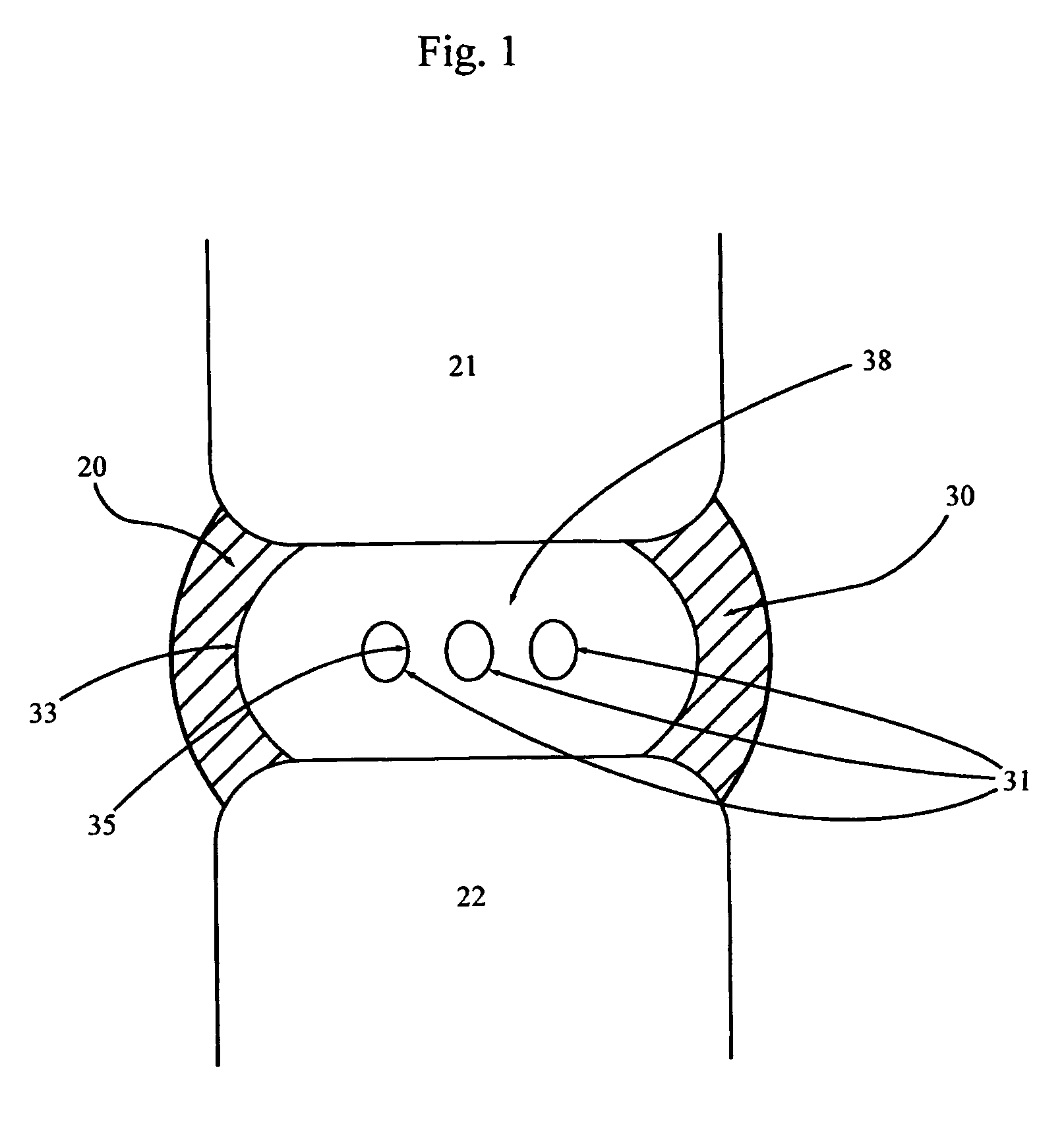 Spinal disc implants with reservoirs for delivery of therapeutic agents