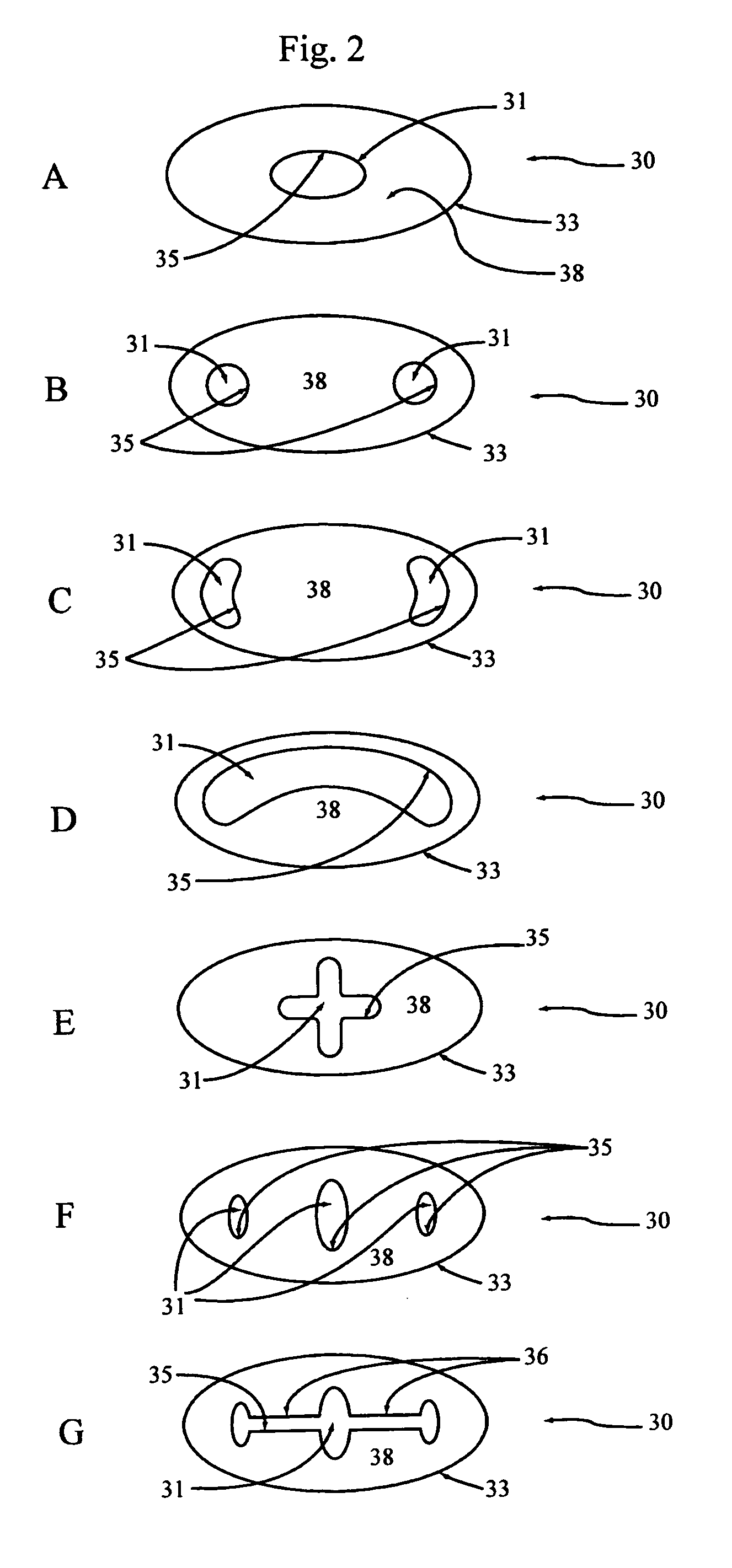 Spinal disc implants with reservoirs for delivery of therapeutic agents