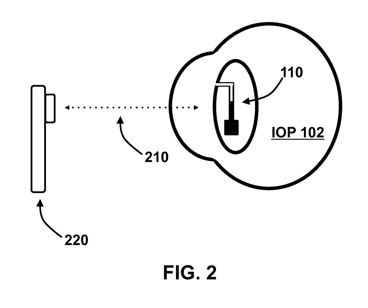 Implantable micro-fluidic device for monitoring of intra-ocular pressure