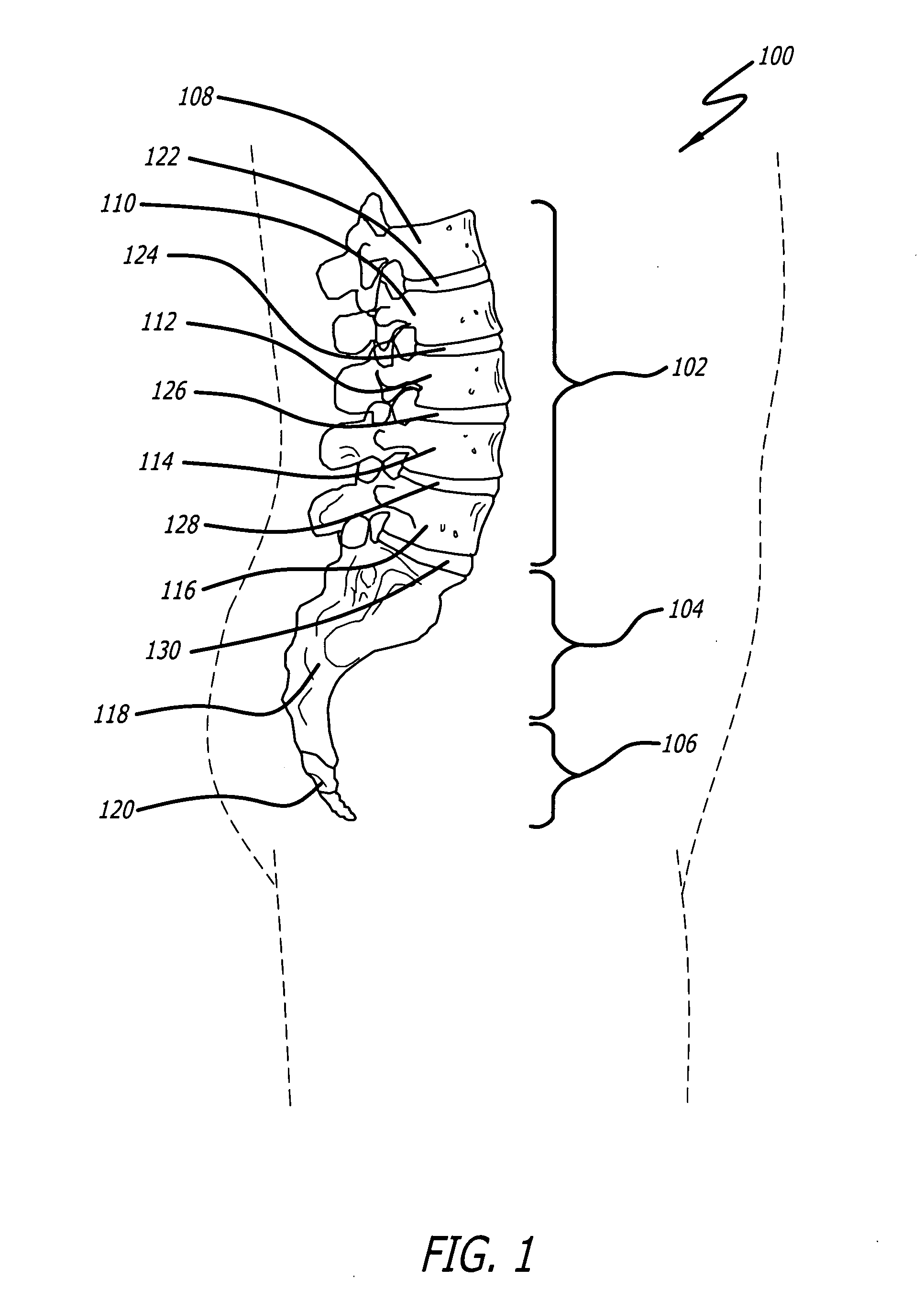 Method of deformity correction in a spine using injectable materials