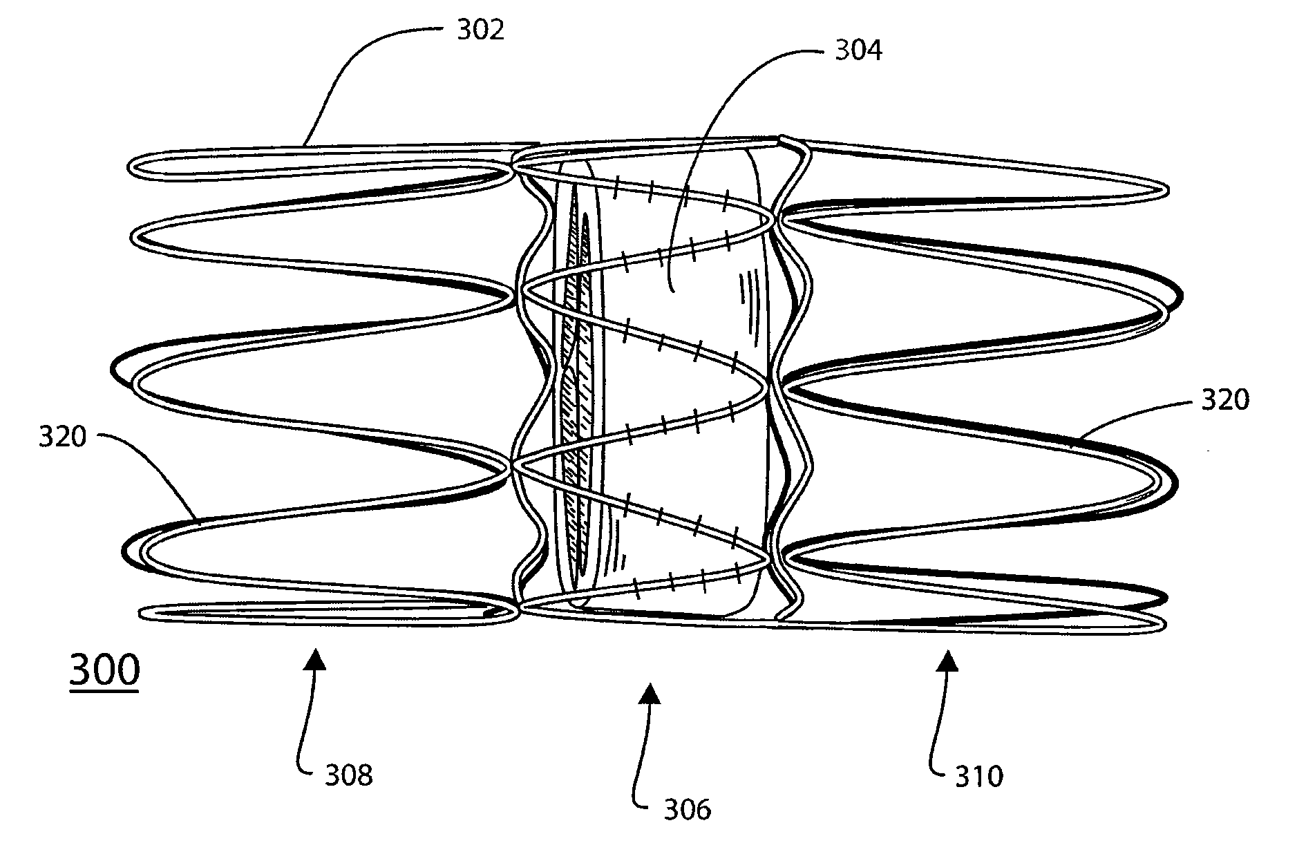 Stented Valve Having Dull Struts