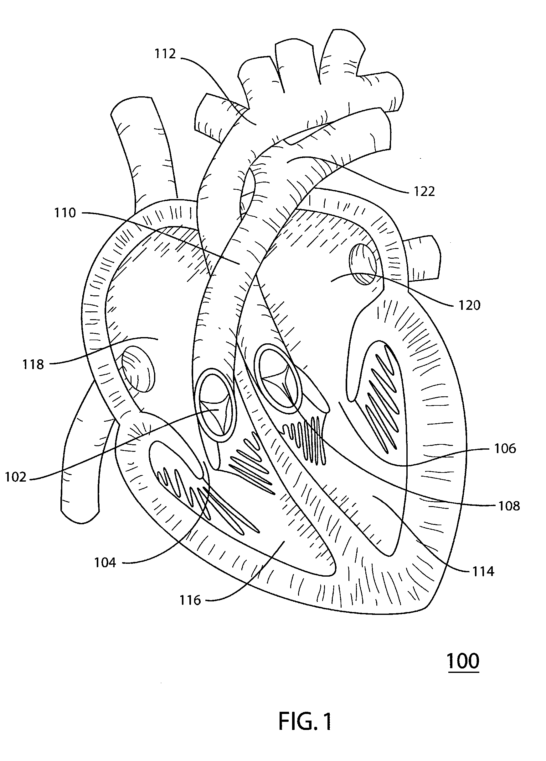 Stented Valve Having Dull Struts