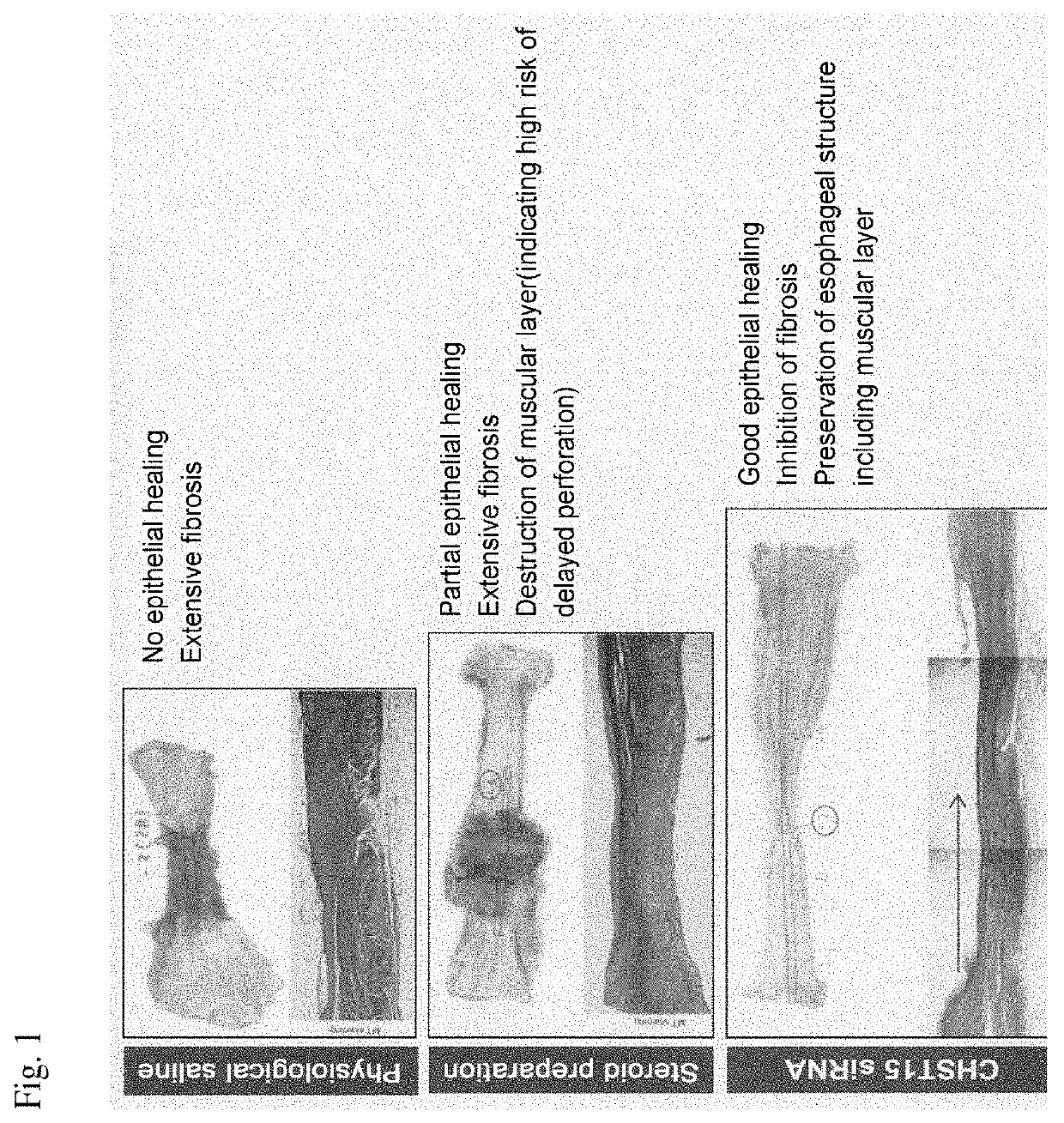 Esophageal stricture suppressing agent