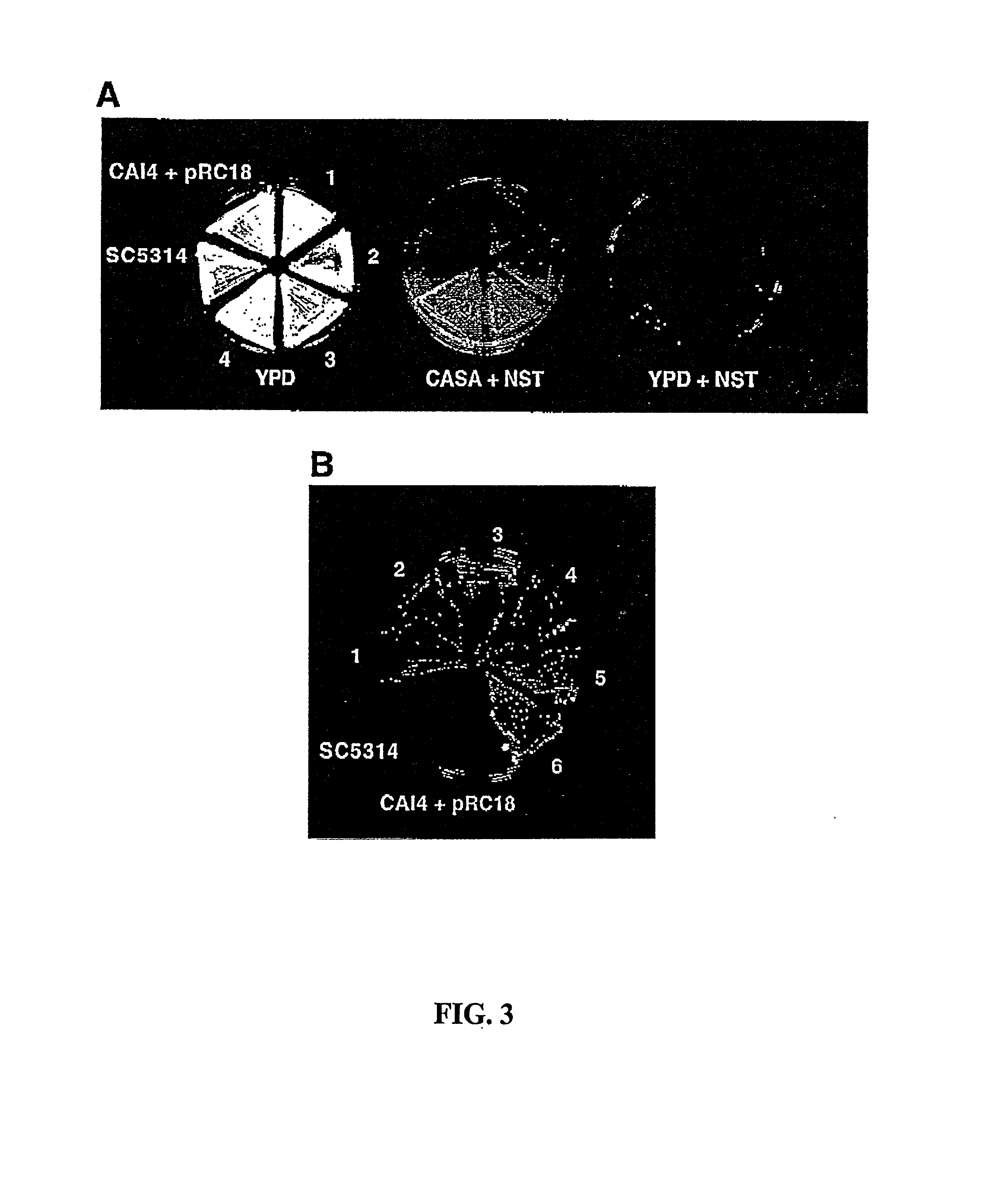 Dominant selectable marker for gene transformation and disruption in yeasts