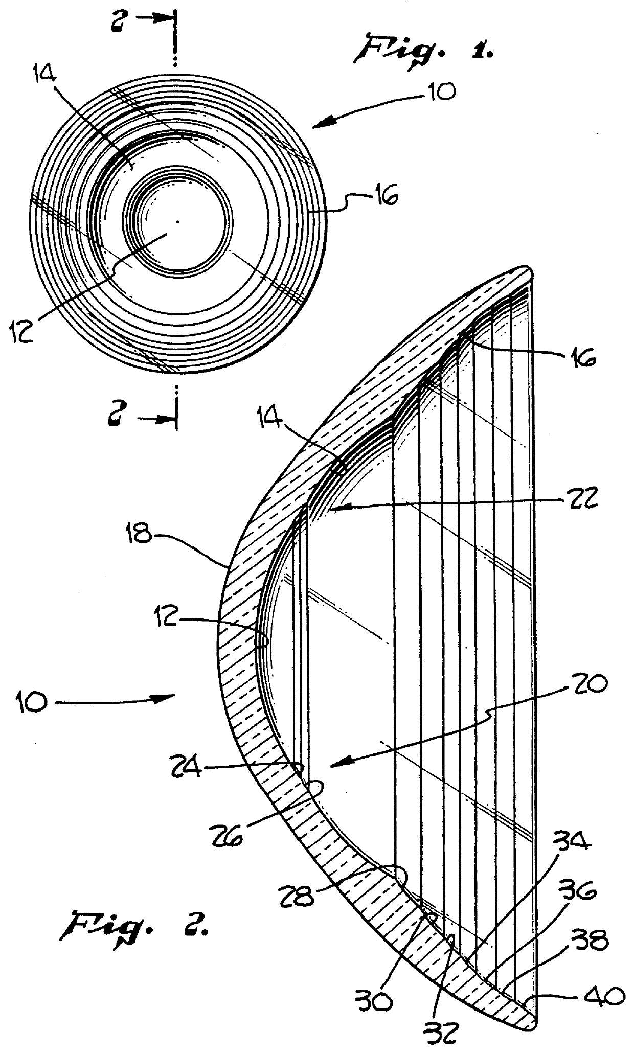 Corneal contact lens and method for treating myopia