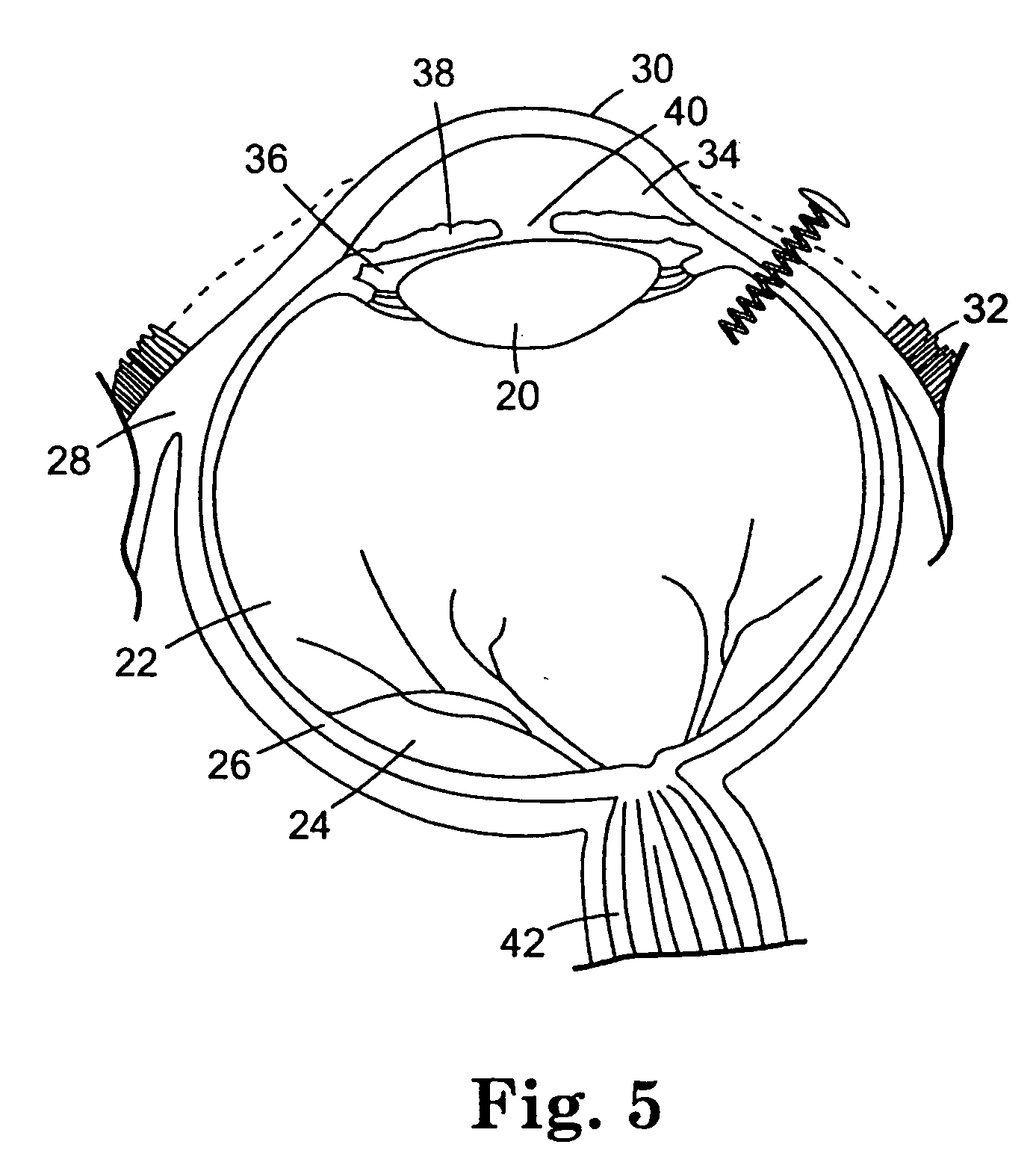 Controlled release bioactive agent delivery device