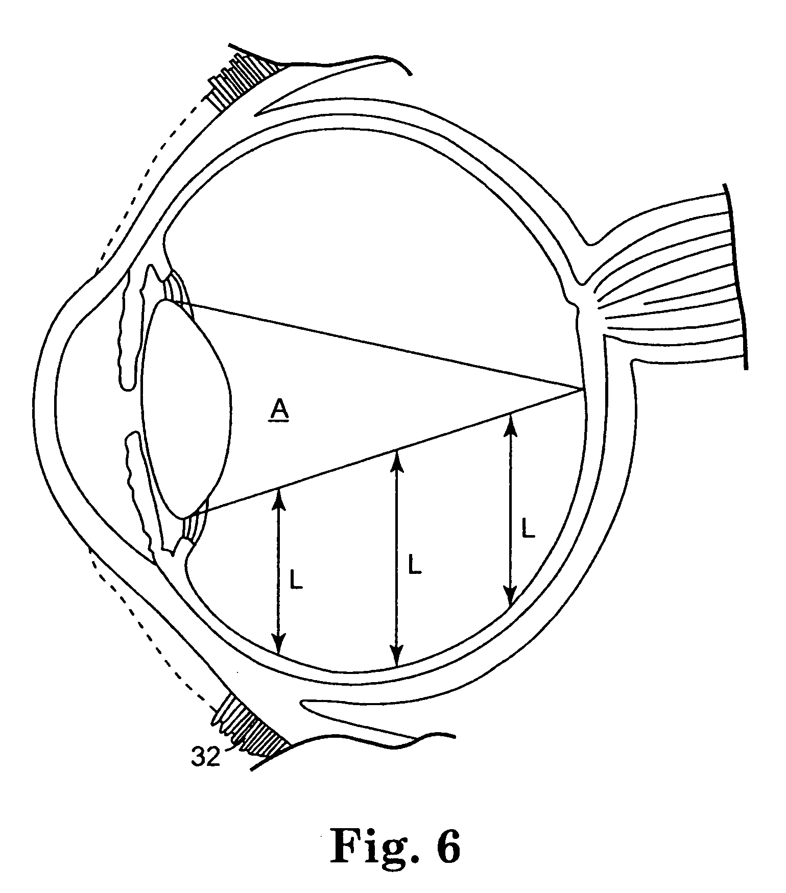 Controlled release bioactive agent delivery device