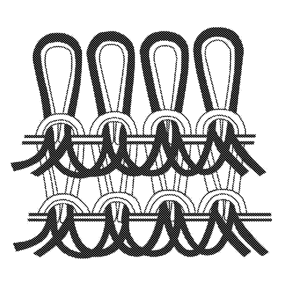 High hygroscopic wound dressing and preparation method and use thereof