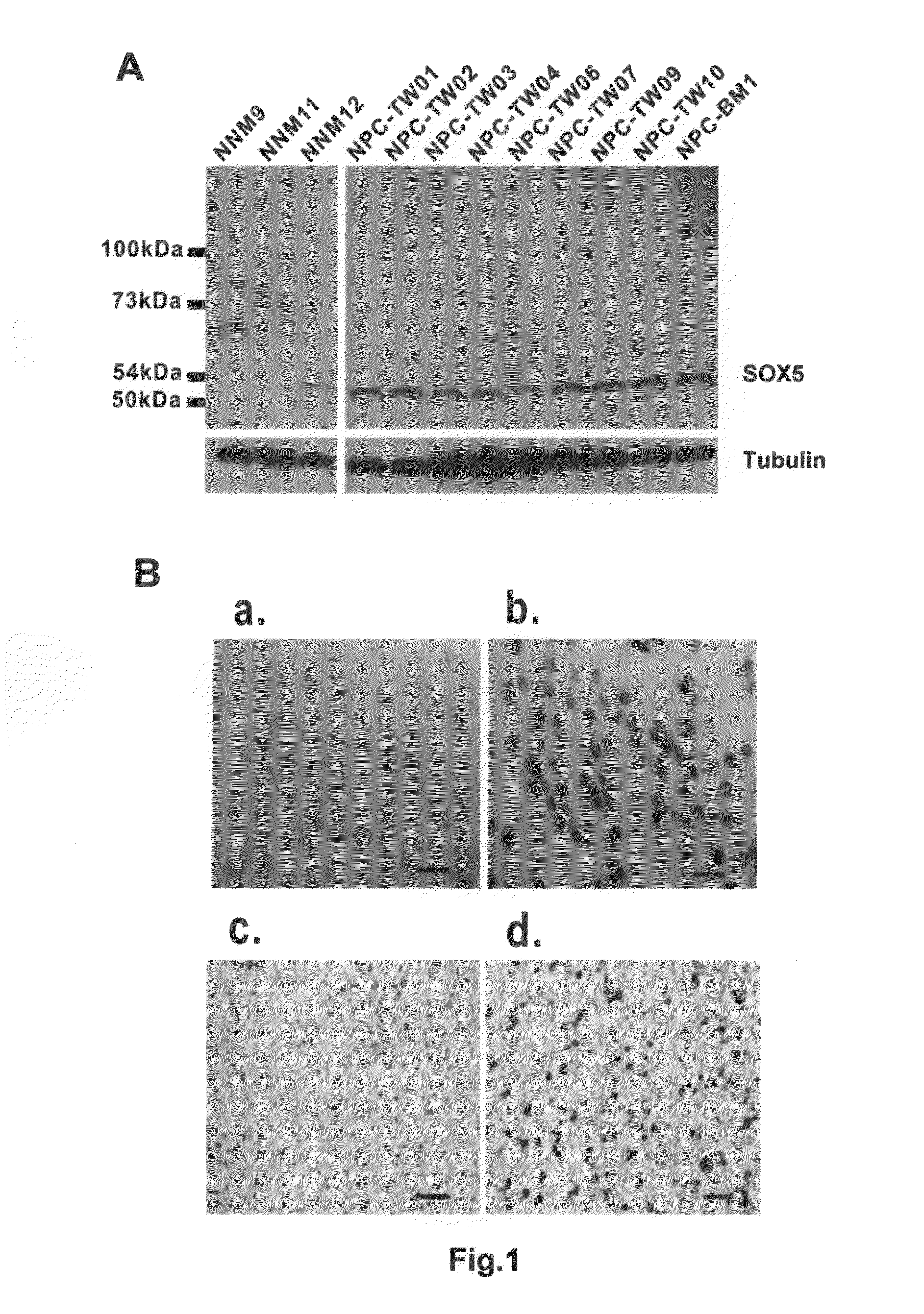 Genetic markers and methods for detecting and treating cancers