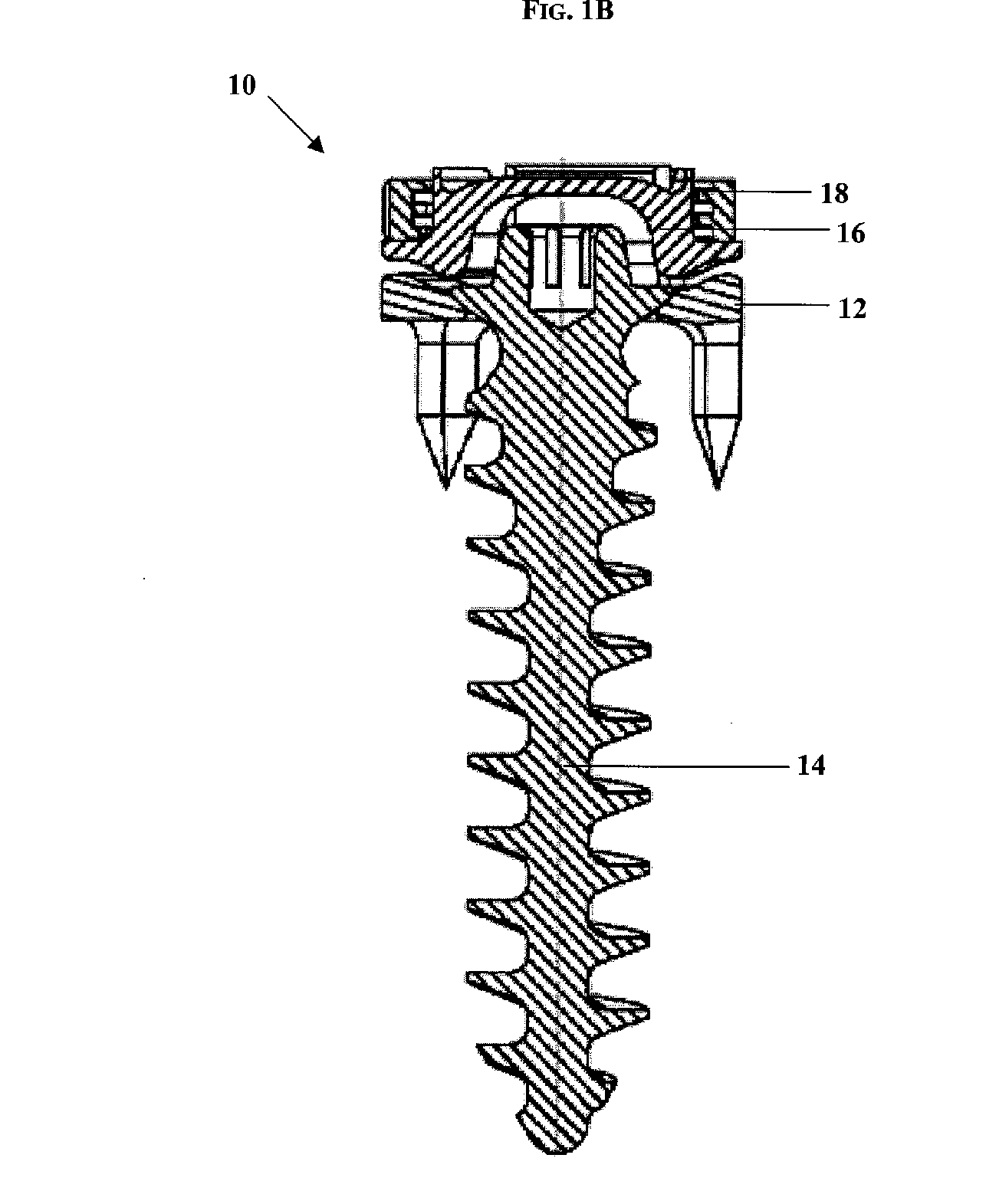 Low profile spinal tethering methods