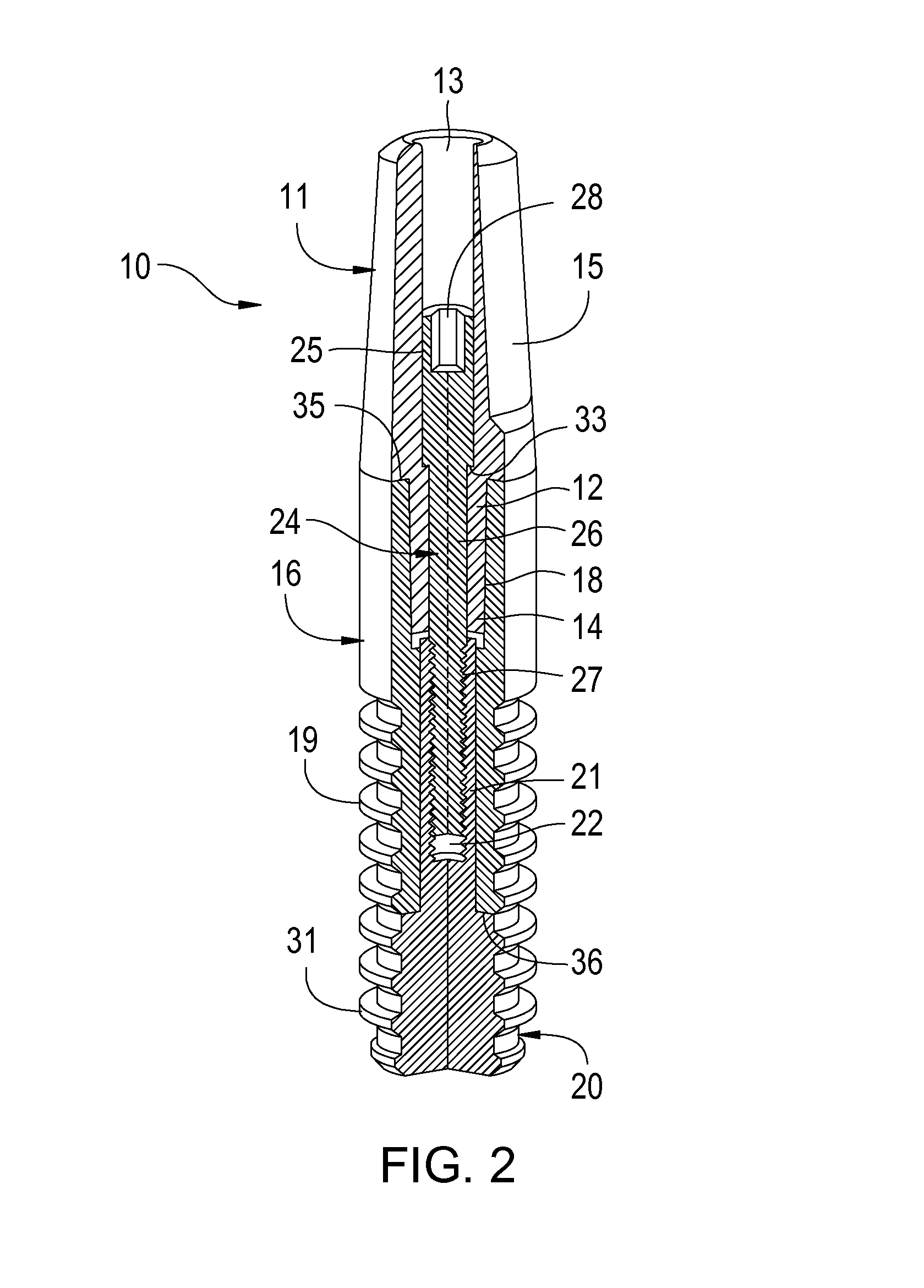 Ceramic and metal composite dental implant