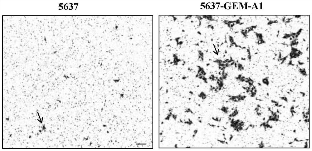 Human bladder cancer gemcitabine drug-resistant cell strain and application thereof