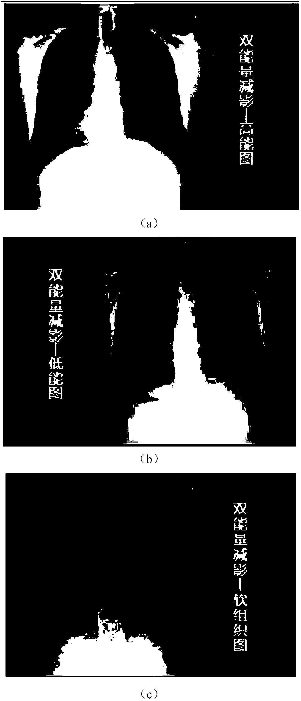 A Dual Energy Subtraction Method Based on DR Machine