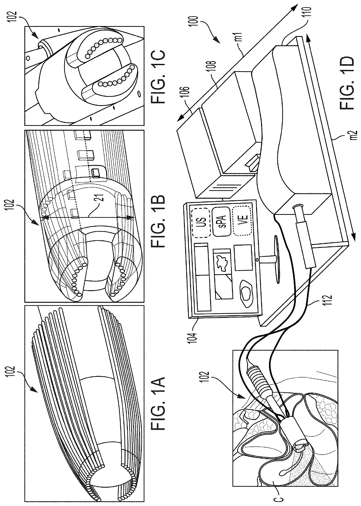 Ultrasound, photoacoustic, and viscoelastic imaging systems and methods for cervical analysis to assess risk of preterm delivery