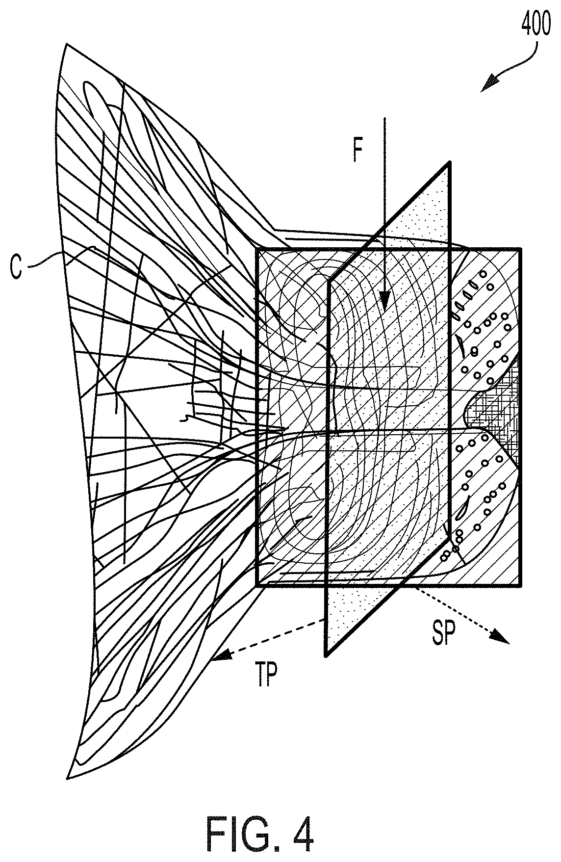 Ultrasound, photoacoustic, and viscoelastic imaging systems and methods for cervical analysis to assess risk of preterm delivery