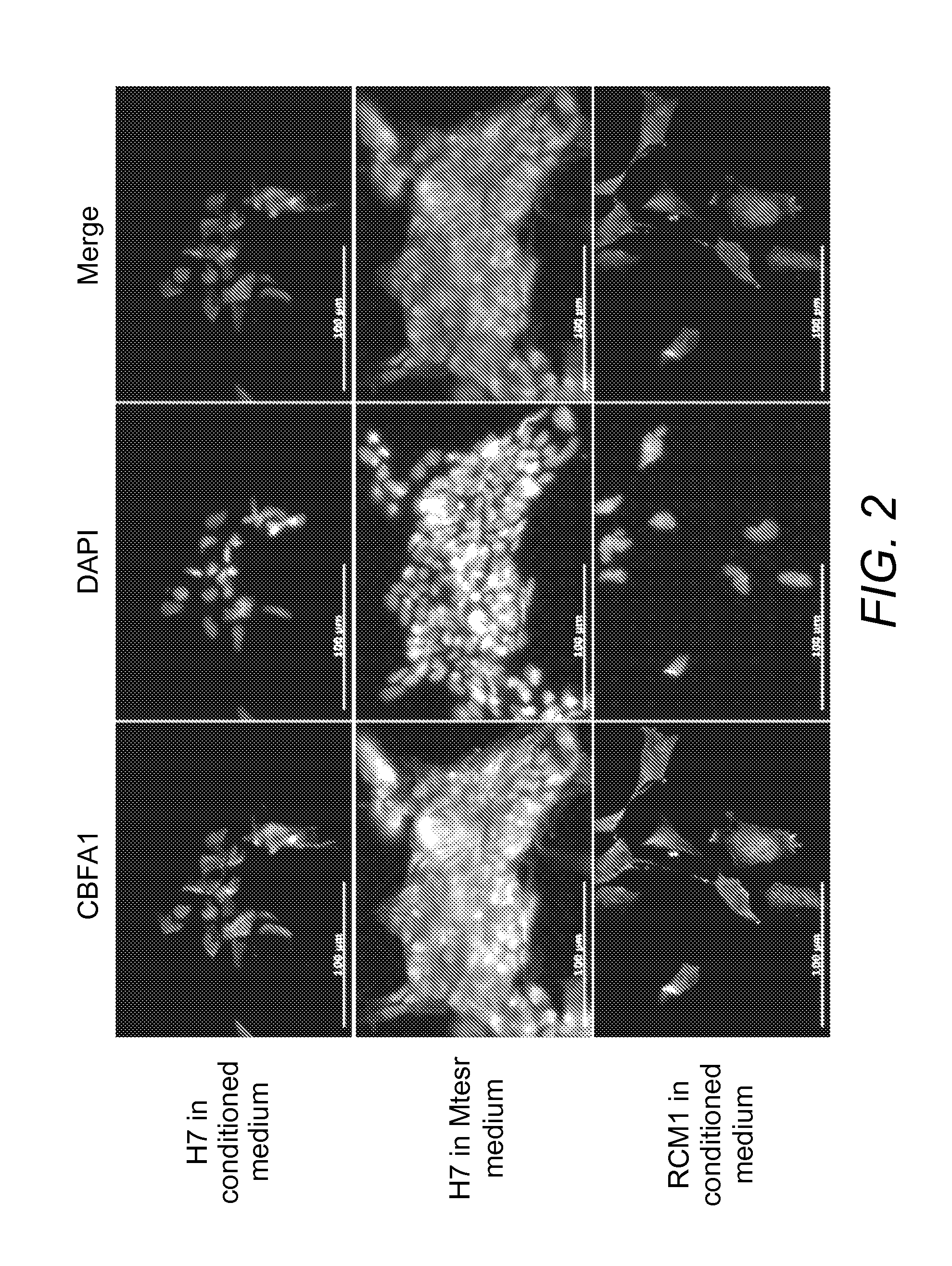 Chondrogenic progenitor cells, protocol for derivation of cells and uses thereof