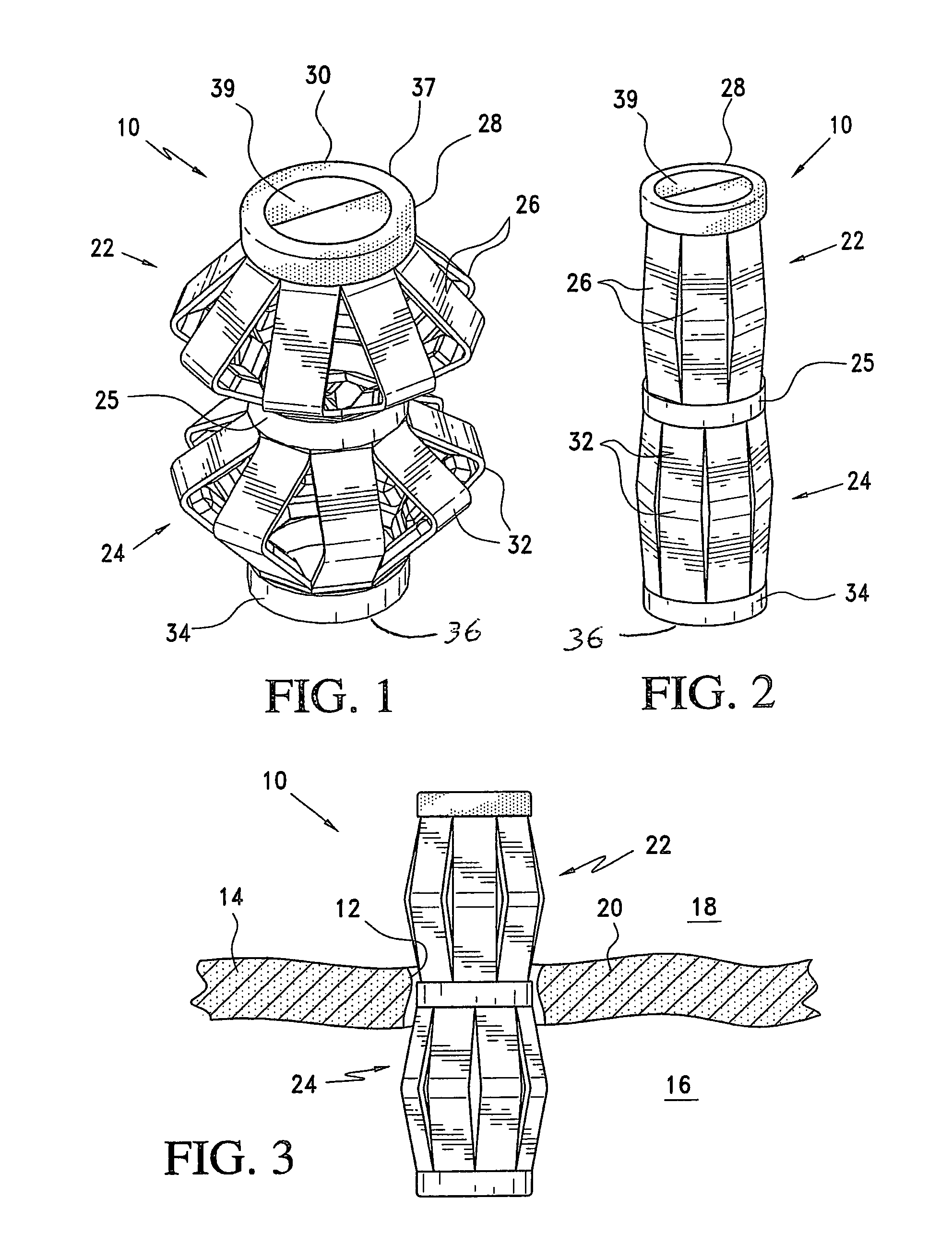 Method and apparatus for sealing a gastric opening