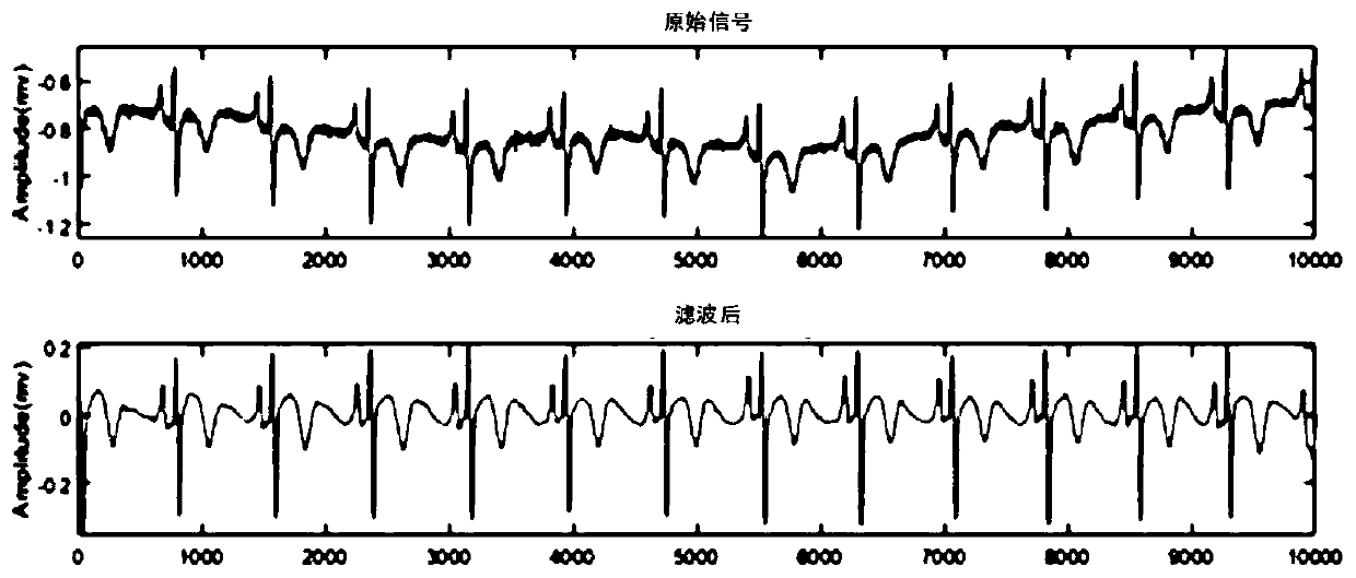 Method and device for multi-scale characteristic extraction based on ECG