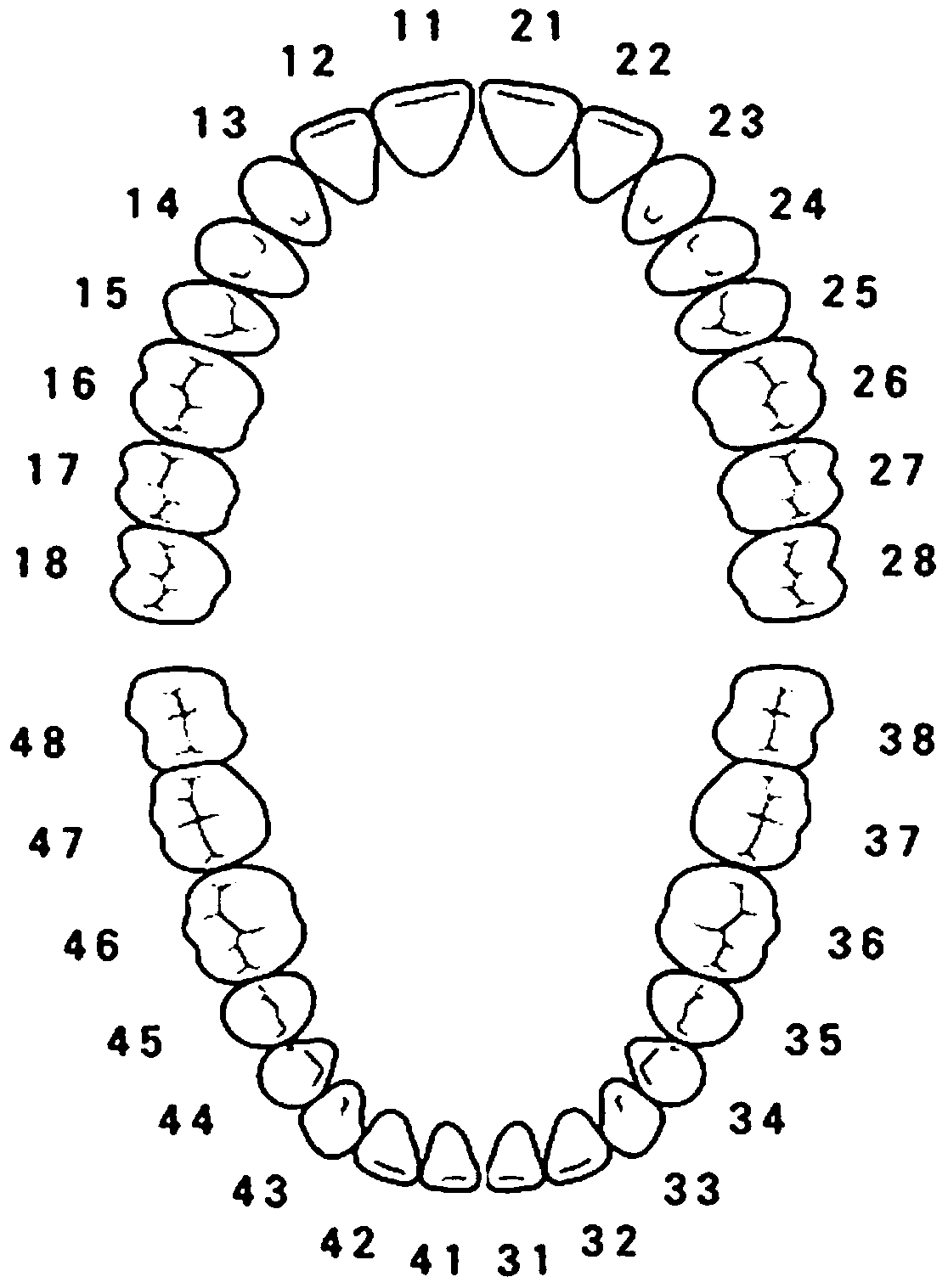 Orthodontic system suitable for mixed dentition and manufacturing method thereof