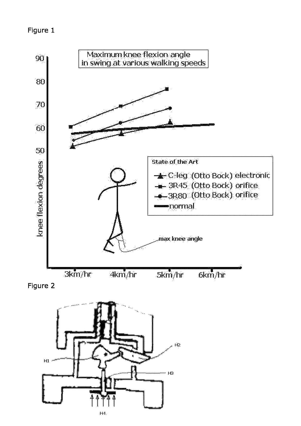 Hydraulic prosthetic joint