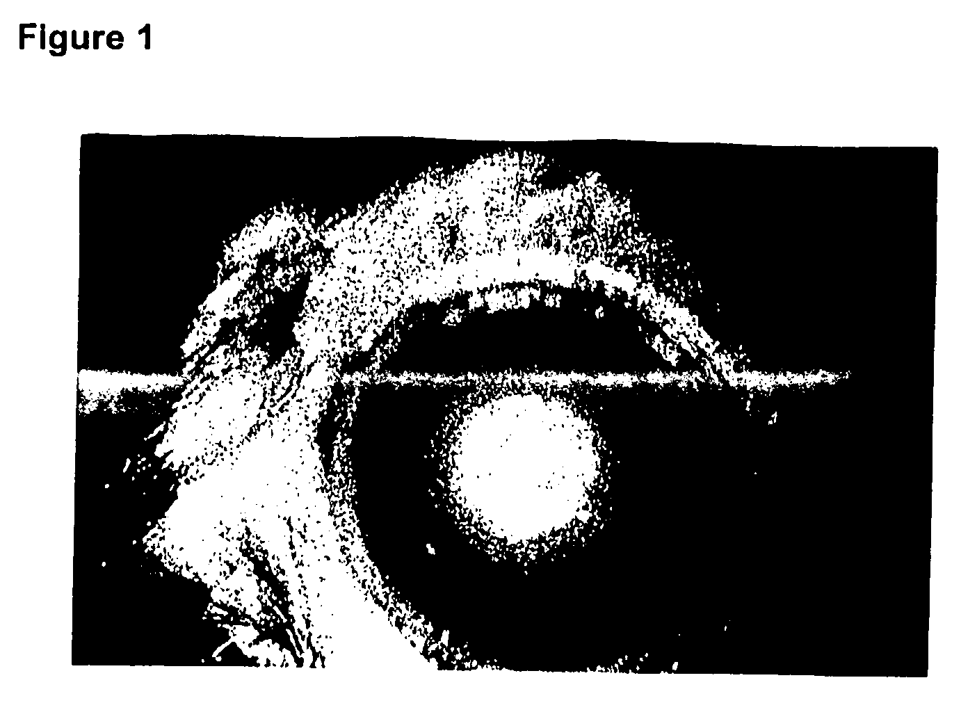 Heparin for the treatment of ocular pathologies