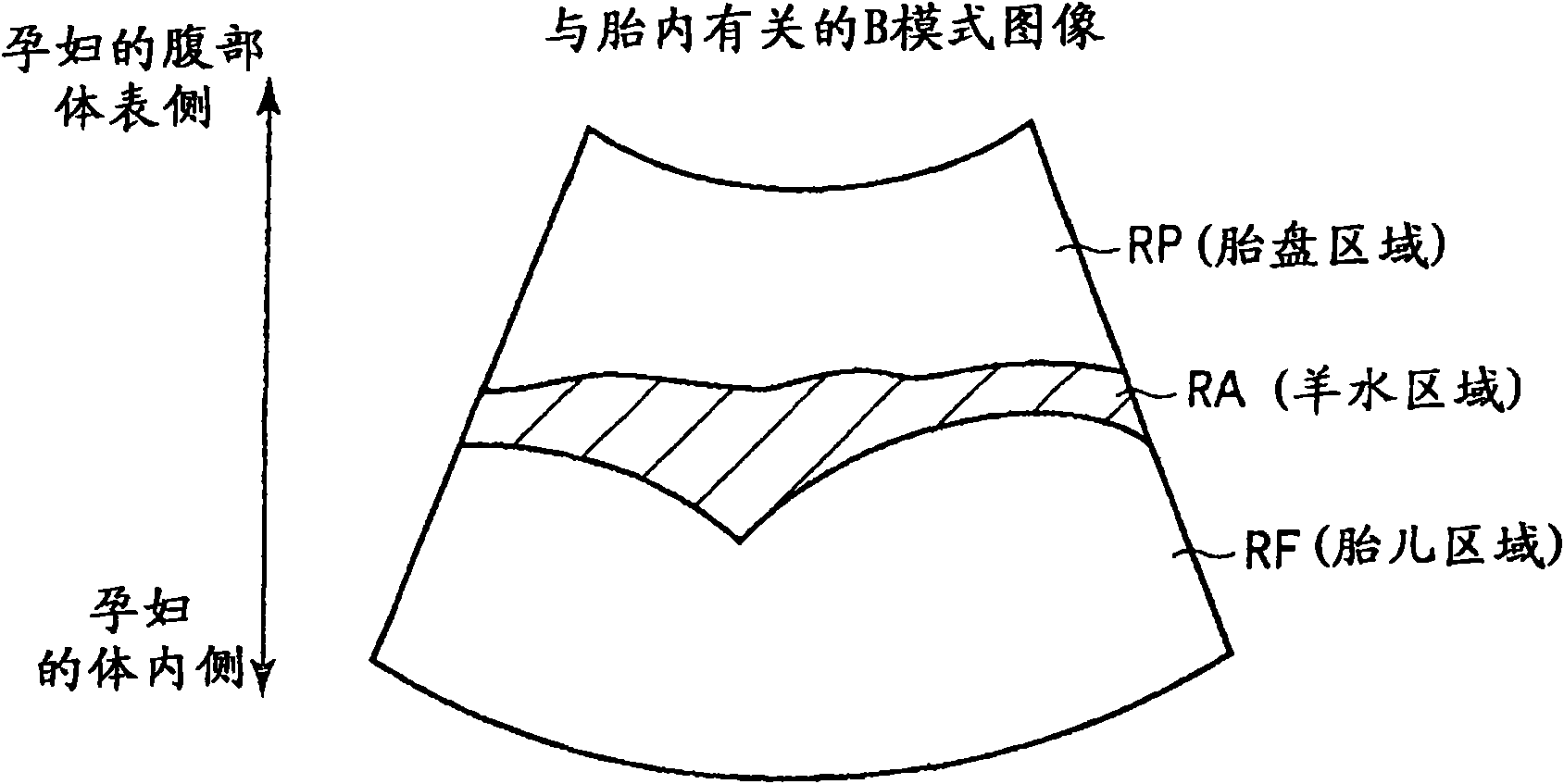 Ultrasonic diagnosis apparatus, ultrasonic image processing apparatus, ultrasonic image processing method, and ultrasonic image processing program