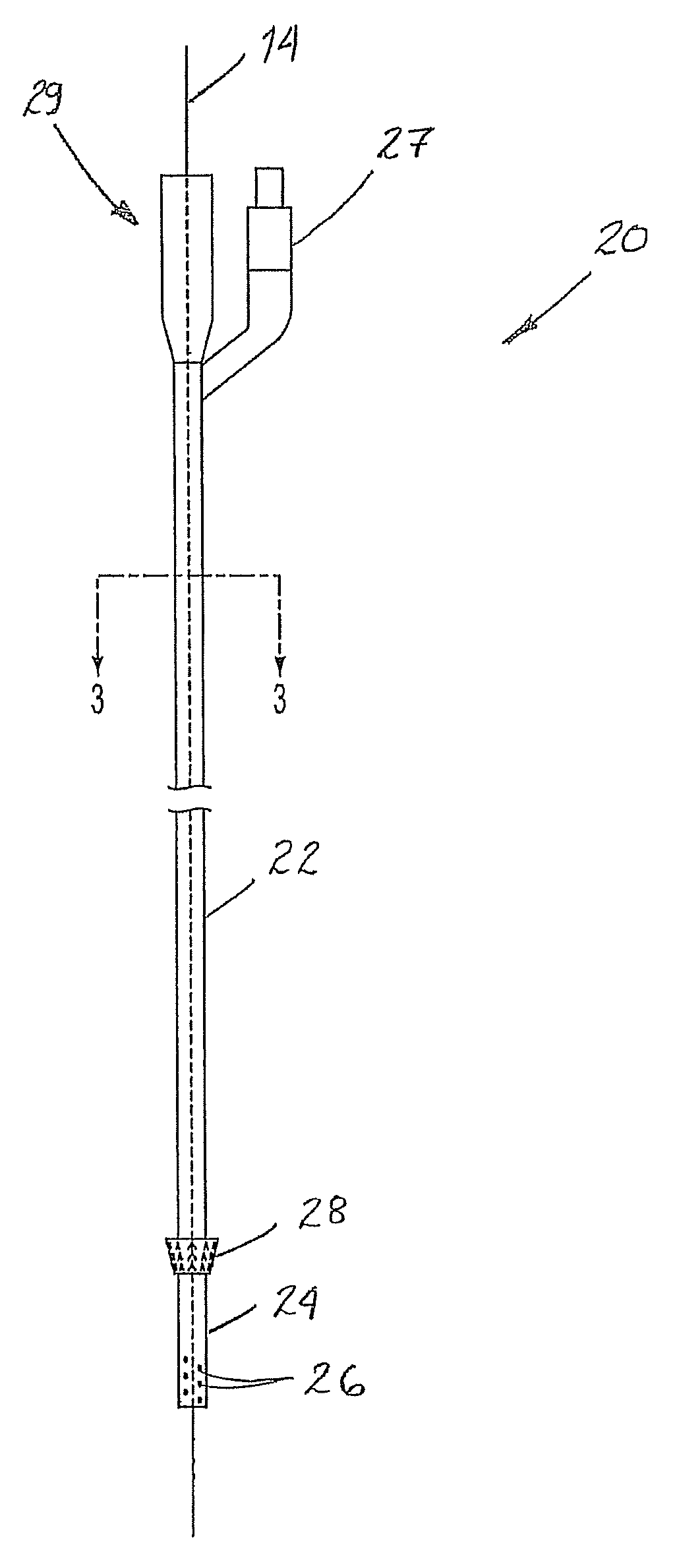 Venous closure catheter and method for sclerotherapy