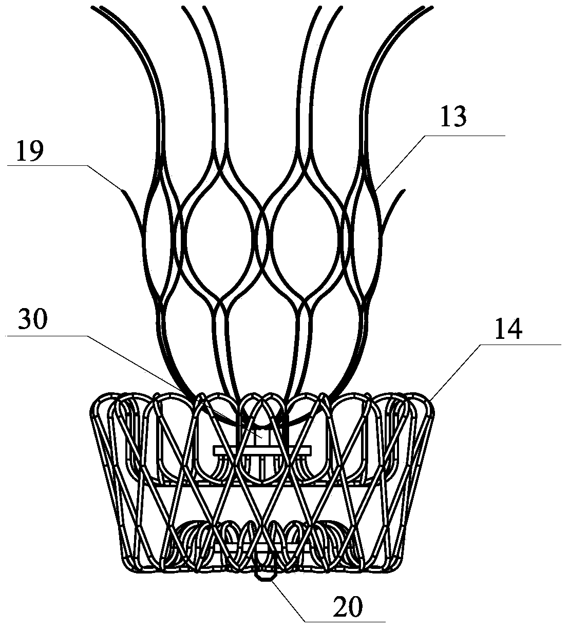 Left Ventricular Volume Reducing Device