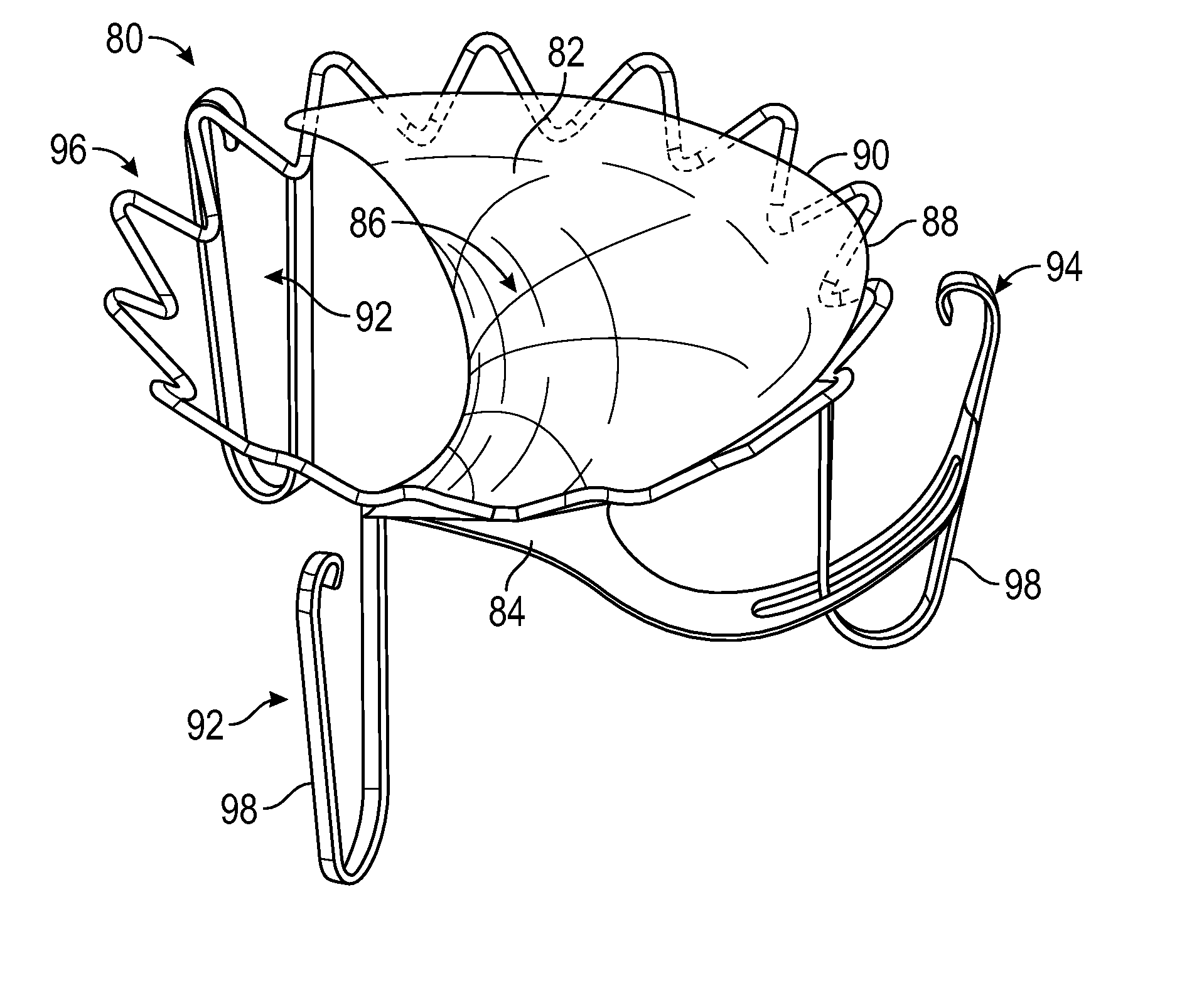 Systems and methods for transcatheter treatment of valve regurgitation