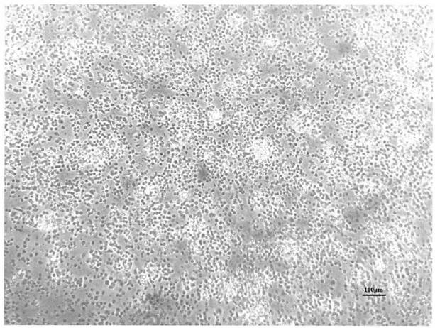 Rapid primary culture method of haliotis discus hannai gill cells and application