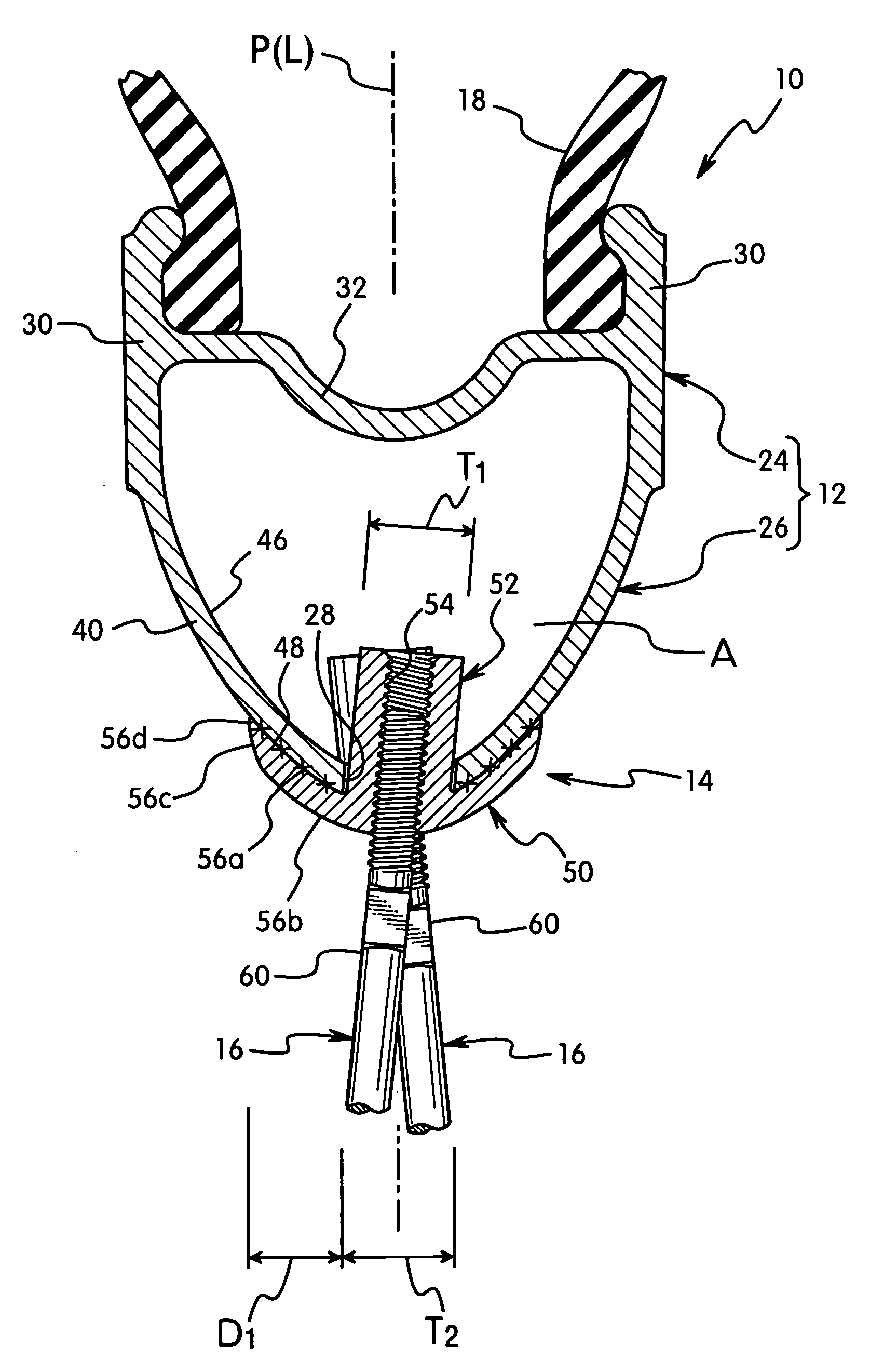 Bicycle rim