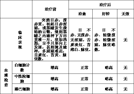 Preparation method of traditional Chinese medicine for treating hypopyon with urine with burning sensation