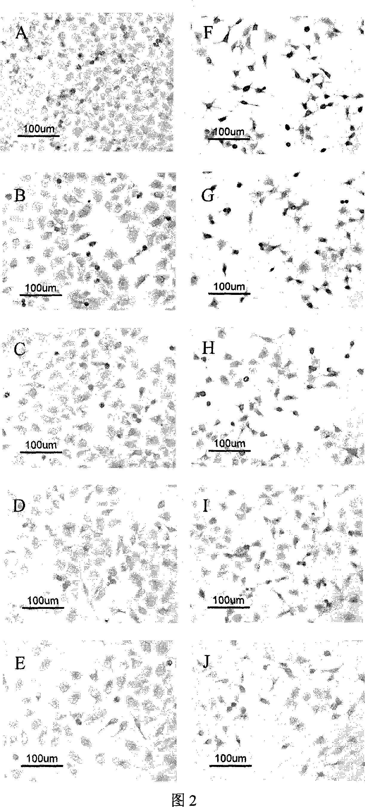 Medical applications of stringy stonecrop ethamol soluble extractive