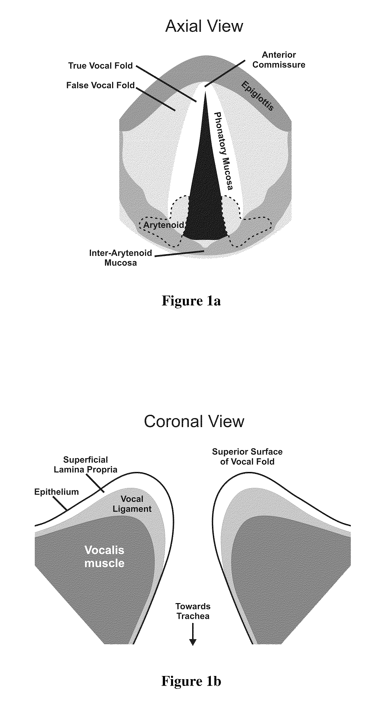 Hydrogels for vocal cord and soft tissue augmentation and repair