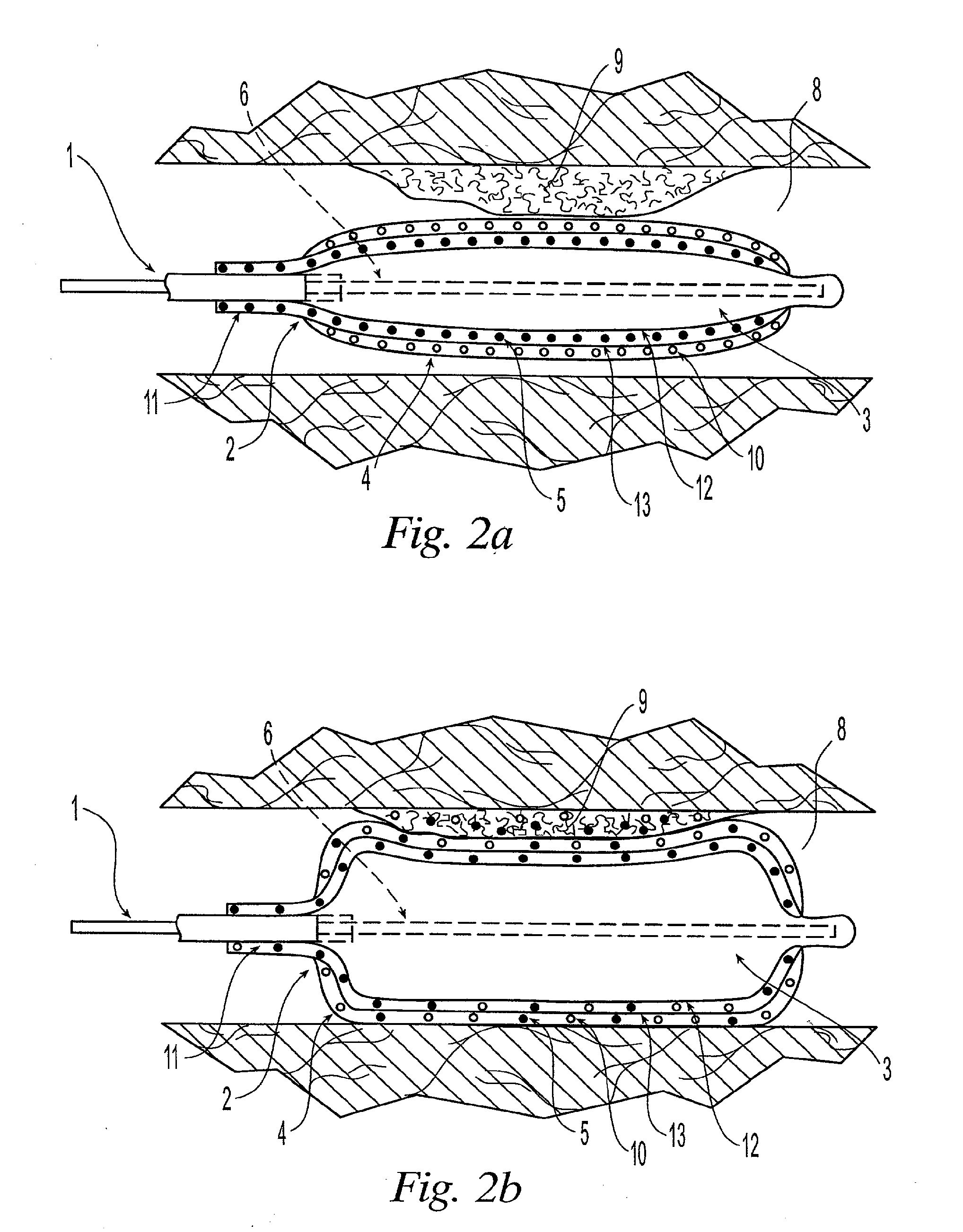 Medical device with sponge coating for controlled drug release