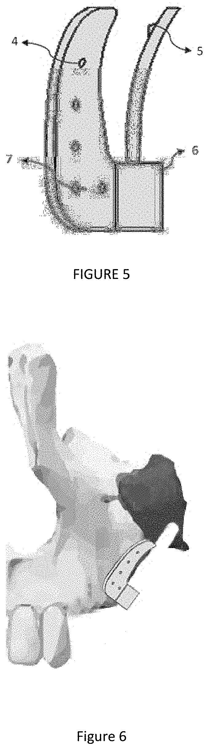 Medical implant and medical implant system for malar process of the maxilla