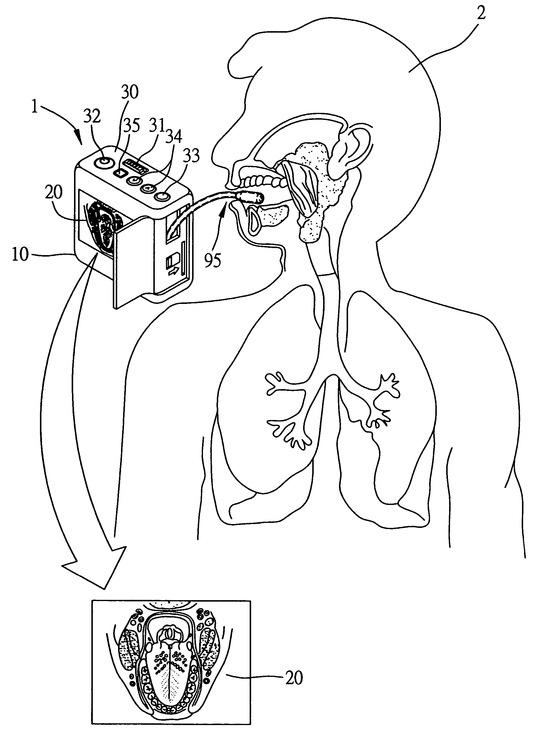 Endoscope apparatus