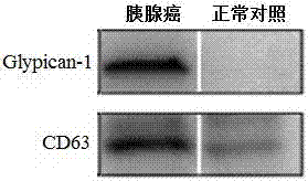 Application of Glypican-1 protein in diagnosis of pancreatic cancer, detection method of positive exosome concentration, and use of detection method