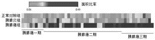 Application of Glypican-1 protein in diagnosis of pancreatic cancer, detection method of positive exosome concentration, and use of detection method