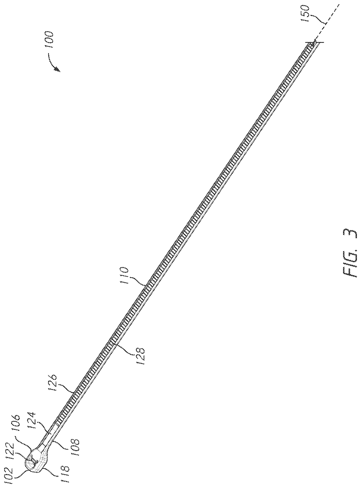 Bone tie methods