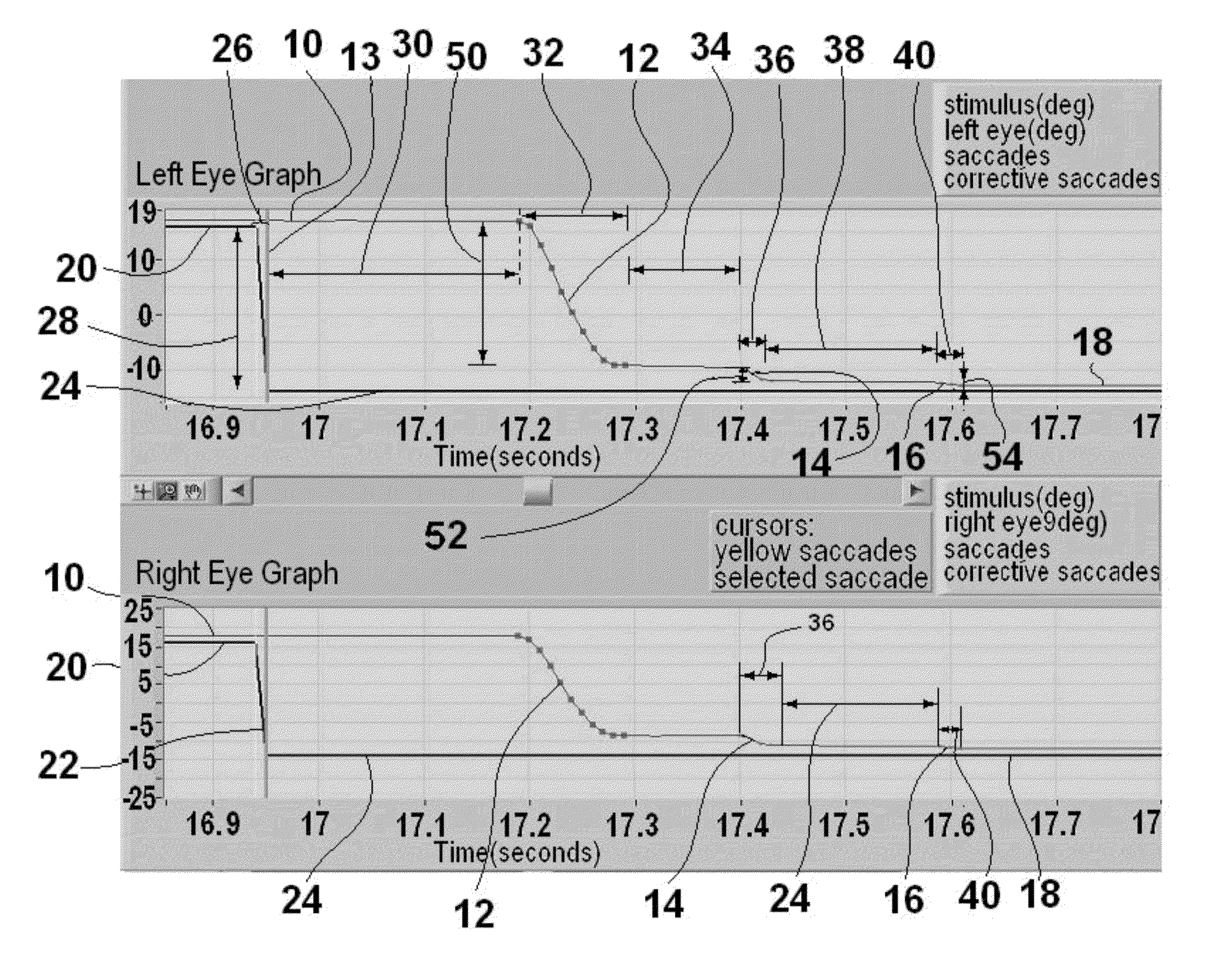 Method and apparatus for corrective secondary saccades analysis with video oculography system