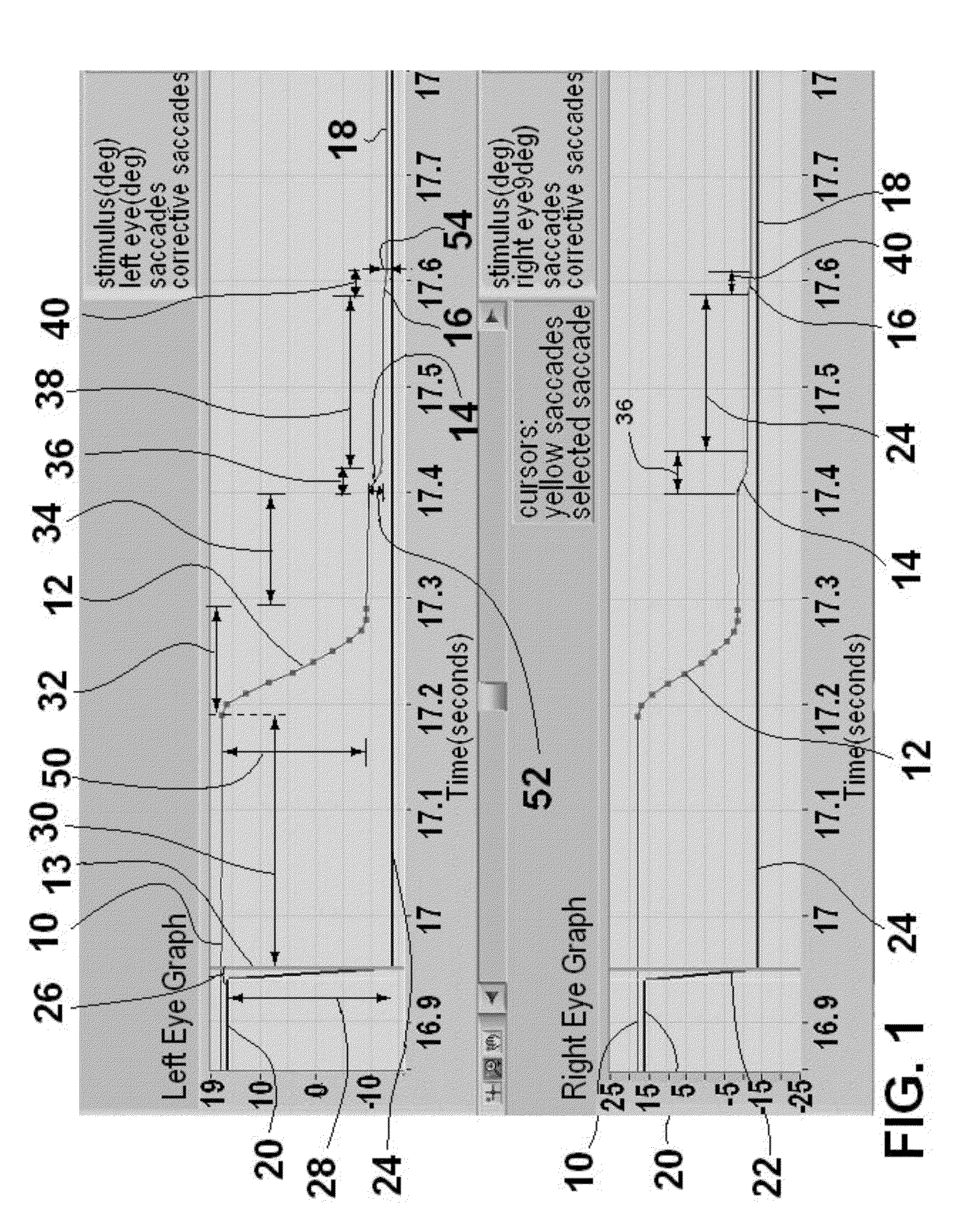 Method and apparatus for corrective secondary saccades analysis with video oculography system