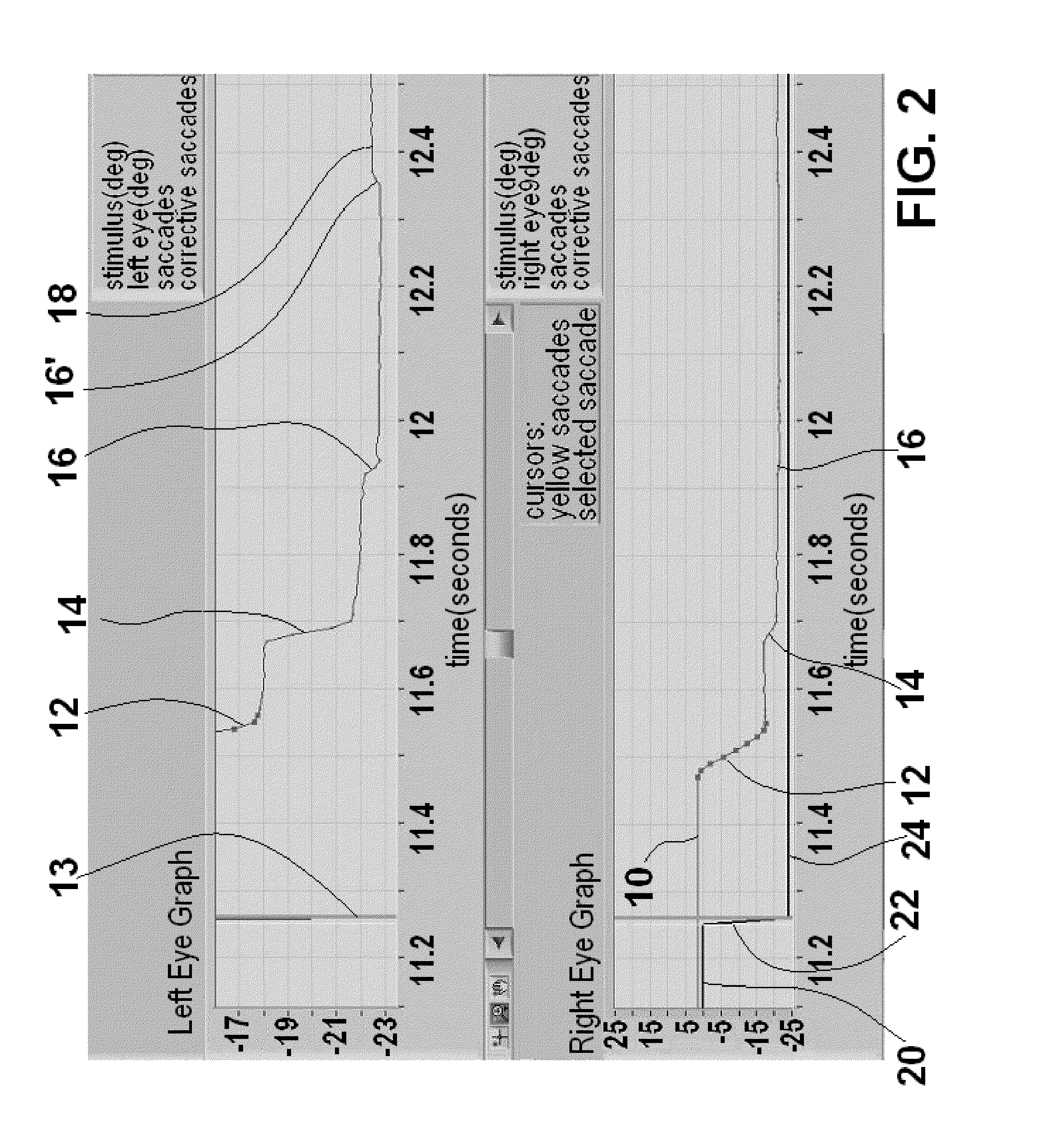 Method and apparatus for corrective secondary saccades analysis with video oculography system